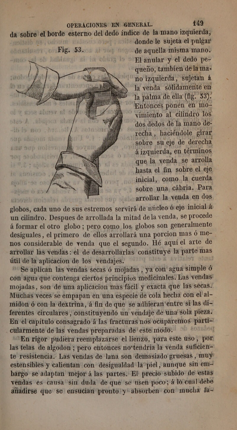 da sobre el borde esterno del dedo índice de la mano izquierda, mn] - donde le sujeta el pulgar Fig: 53. ¿E de aquella misma mano. ' El anular y el dedo pe- queño, tambien dela ma: no izquierda, sujetan à la venda sélidamente en la palma de ella (LEA 53). Entonces ponén en mo- -vimiento al cilindro los dos dedos de la mano de- echa, haciéndole girar - sobre su eje de derecha á izquierda, en términos que la venda se arrolla hasta el fin sobre el eje inicial, como, la cuerda sobre una, cábria. Para NE Ay arrollar. la venda en dos ds. cada uno dé sus estremos servirá de núcleo ó-eje inicial &amp; un cilindro. Despues de arrollada la mitad de la venda, se procede á formar el otro globo; pero como los. globos son generalmente nos considerable de venda que el segundo. Hé aquí el arte de arrollar las vendas : el de desarrollarlas Cb As la LE mas ” de la aplicacion de los vendajes. Se aplican las vendas secas 6 mojadas , ya con agua Eitlalto Ô con agua que contenga ciertos principivs medicinales. Las vendas mojadas, son de una aplicacion mas fácil y exacta que las secas. Muchas veces se empapan en una especie de cola hecha con el al- midon 6 con-la déxtrina, 4 fin de que se adhieran 'entre si las di- ferentes circulares, constituyendó un vendaje de una' sola pieza. En el capítulo consagrado 4 las fracturas nos octiparemos: partes cularmente de las vendas preparadas de' este: modo. > En rigor pudiera reemplazarse el lienzo, para este uso , por las telas de algodon ; pero entonces notendria la venda suficien= te resistencia. Las vendas de lana son demasiado gruesas , muy estensibles y calientan con desigualdad la” piel, aunque sin em- bargo se adaptan mejor 4 las partes. El precio subido de 'estas vendas es causa “sin duda de que se usen poco; á ló cual debe añadirse que se ensucian pronto'y' absorben con mucha fa=
