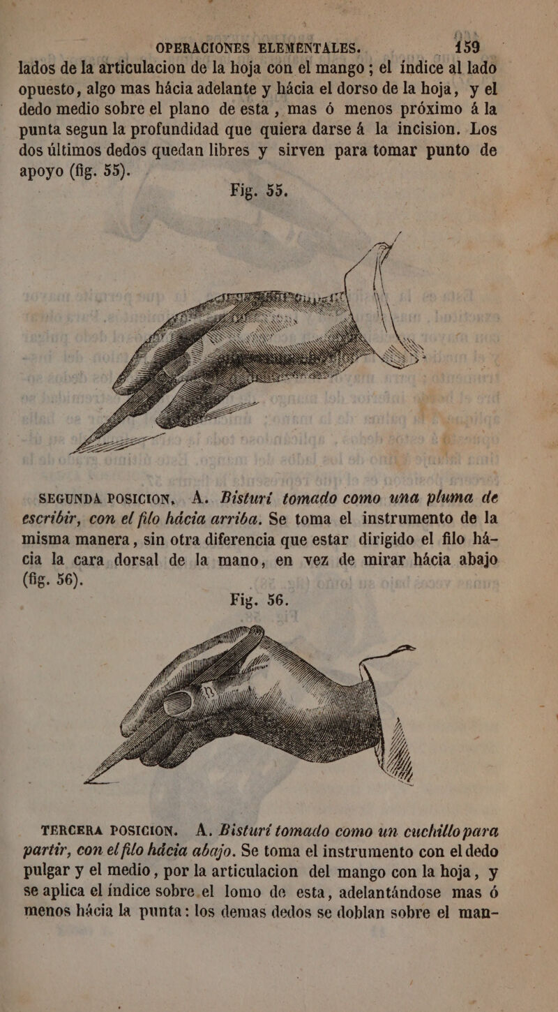 lados de la articulacion de la hoja con el mango ; el indice al lado opuesto, algo mas hácia adelante y hácia el dorso de la hoja, y el dedo medio sobre el plano de esta , mas ó menos próximo ála punta segun la profundidad que quiera darse 4 la incision. Los dos últimos dedos quedan libres y sirven para tomar punto de apoyo (fig. 55). . | | Fig. 55. NS y NS NN A S SS WS SS SS SOS S S SIS à À NS \ SEGUNDA POSICION, À. Bisturí tomado como una pluma de escribir, con el filo hácia arriba. Se toma el instrumento de la misma manera, sin otra diferencia que estar dirigido el filo há- cia la cara dorsal de la mano, en vez de mirar hácia abajo (fig. 56). TERCERA POSICION. À. Bisturí tomado como un cuchillo para partir, con el filo häcia abajo. Se toma el instrumento con el dedo pulgar y el medio, por la articulacion del mango con la hoja, y se aplica el índice sobre.el lomo de esta, adelantándose mas ó menos hácia la punta: los demas dedos se doblan sobre el man-
