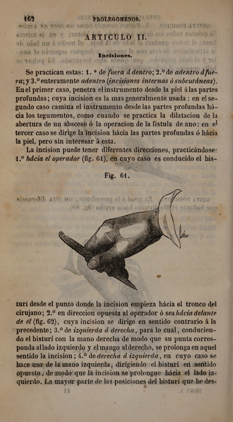 eros NA CNE 2 LE 2 # . Lo Incisiones. Sa Se practican estas: 1. ° de fuera d dentro; 2.9 de adentro dfue- ra; y 3.°enteramente adentro (incisiones internas ó subcutáneas). Enel primer caso, penetra elinstrumento desde la piel 4las partes profundas; cuya incision es la mas generalmente usada : en el se- gundo caso camina el instrumento desde las partes profundas há- cia los tegumentos, como cuando se practica la dilatacion de la abertura de un absceso ó la operacion de la fístula de ano: en el tercer caso se dirige la incision hácia las partes profundas ó hácia la piel, pero sin interesar á esta. La incision puede tener diferentes direcciones, practicándose: 1.2 hácia el operador (fig. 61), en cuyo caso es conducido el bis- turi desde el punto donde la incision empieza hácia el tronco del cirujano; 2. en direccion opuesta al operador 6 sea hácia delante de el (fig. 62), cuya incision se dirige en sentido contrario à la precedente; 3.° de ¿zguierda à derecha, para lo cual, conducien- - do el bisturí con la mano derecha de modo que su punta corres- ponda al lado izquierdo y el mango alderecho, se prolonga en aquel sentido la incision ; 4.2 de derecha à izquierda, en cuyo caso se bace-uso: de la mano izquierda, dirigiendo el bisturi en «sentido opuesto ; de.modo'que la incision se prolongue: hácia el lado iz- quierdo. La mayor parte de las posiciones del bisturí que he des-