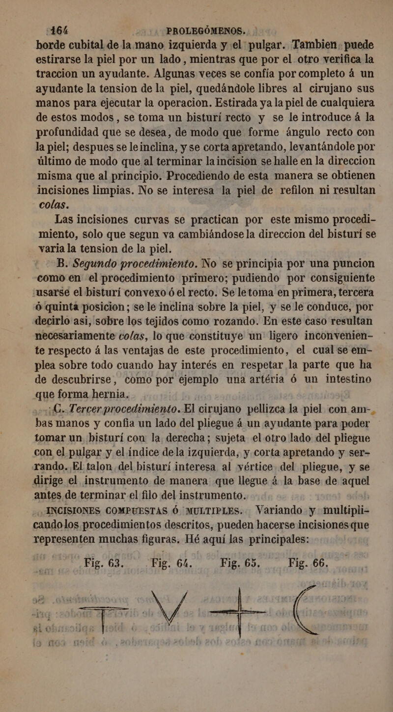 borde cubital de la mano izquierda y el pulgar. Tambien puede estirarse la piel por un lado, mientras que por el otro verifica la traccion un ayudante. Algunas veces se confía por completo á un ayudante la tension de la piel, quedándole libres al cirujano sus manos para ejecutar la operacion. Estirada ya la piel de cualquiera de estos modos , se toma un bisturi recto y se le introduce à la profundidad que se desea, de modo que forme ángulo recto con la piel; despues se leinclina, y se corta apretando, levantándole por último de modo que al terminar la incision se halle en la direccion misma que al principio. Procediendo de esta manera se obtienen incisiones limpias. No se interesa la pal de refilon ni resultan colas. Las incisiones curvas se ota por este mismo procedi- miento, solo que segun va cambiándose la direccion del bisturi se varia la tension de la piel. - B. Segundo procedimiento. No se principia por una puncion como en el procedimiento primero; pudiendo por consiguiente usarse el bisturi convexo ó el recto. Se letoma en primera, tercera ó quinta posicion; se le inclina sobre la piel, y se le conduce, por decirlo asi, sobre los tejidos como rozando. En este caso resultan necesariamente colas, lo que constituye un ligero inconvenien- te respecto á las ventajas de este procedimiento, el cual se em- plea sobre todo cuando hay interés en respetar la parte que ha de descubrirse, como por ejemplo una artéria ó un intestino que forma hernia. :C. Tercer procedimiento. El cirujano pellizca la piel con am-, bas manos y confia un lado del pliegue á un ayudante para poder tomar un bisturí con la derecha; sujeta el otro lado del pliegue con el pulgar y el índice dela izquierda, y corta apretando y ser- rando. El talon del bisturí interesa al vértice del pliegue, y se dirige el instrumento de manera que llegue 4 la base de aquel antes de terminar el filo del instrumento. | INCISIONES COMPUESTAS Ó MULTIPLES. Variando y multipli- cando los procedimientos descritos, pueden hacerse incisiones que representen muchas figuras. Hé aqui las principales: Fig. 63. Fig. 64. Fig. 65. Fig. 66,