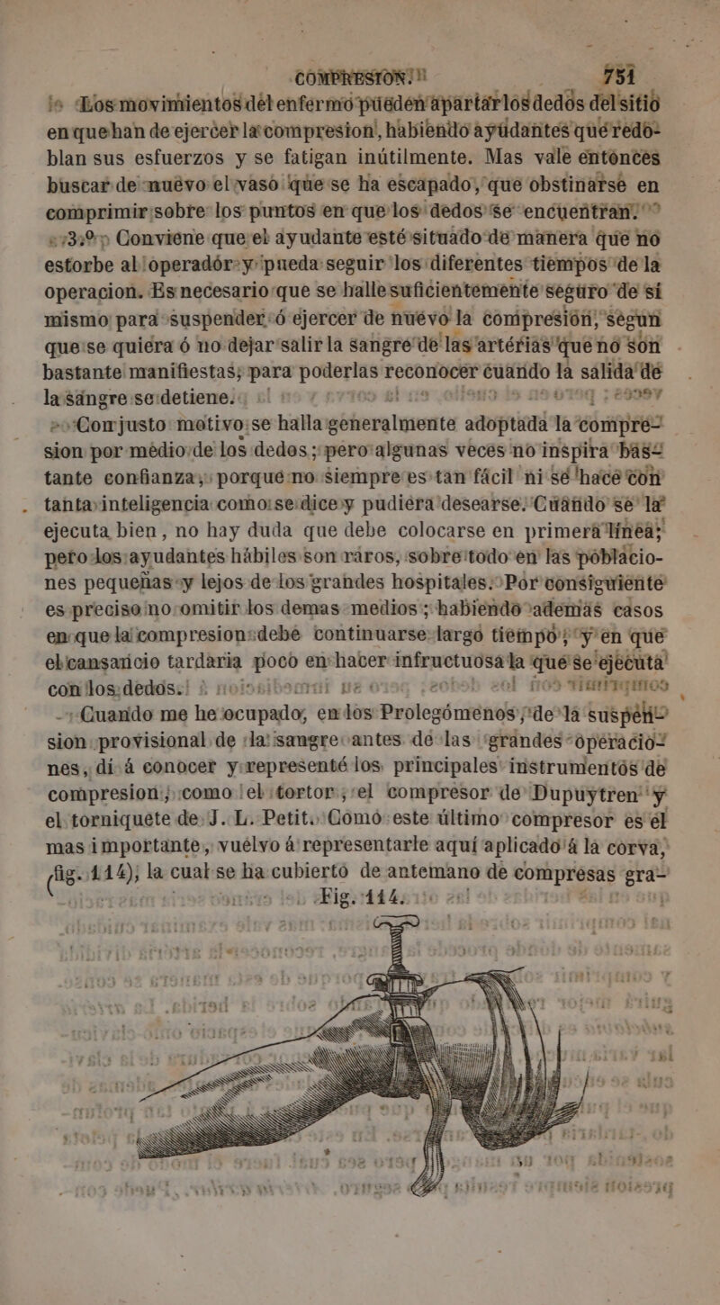 COMPRESSION! 1 ss | ja Los movinkientosdél enfermo pueden apartarlos dedós del sitio en quehan de ejercer lacompresion', habiendo ayúdantes quéredo: blan sus esfuerzos y se fatigan inútilmente. Mas vale entónces buscar de muévo el vaso quese ha escapado, que obstinarse en comprimir:sobre los puntos en que los dedos $e encuentran. &gt;? 132%; Conviene que el ayudante esté situado de manera que no estorbe al operadór-y'pueda: seguir los diferentes tiempos de la Operacion. Es necesario que se halle suficientemente seguro de si mismo para suspender:6 ejercer de nuévo la compresión; segun que:se quiera 6 no dejar'salir la sangre “de las'artérias que no són bastante manifiestas; para RATS ROBBLIAESE ‘euxnido la salida de 1 sangre sedetiene.:: :! 1 : MINS (19 079 ¿9991 “Cor justo: metivo:se halla meda eomia la compre- sion por médio:de los dedos; «pero algunas veces no inspira bas£ tante confianza; porque mo siempre es tan fácil ni sé 'hacé ton tanta» inteligencia: comoise:dicey pudiera desearse. Cuando se la ejecuta bien, no hay duda que debe colocarse en primera líneá; pero los:ayudantes hábiles son ráros, sobretodo en las póblacio- nes pequeñas «y lejos de los grandes hospitales:&gt;Por consiguiente es preciso noomitir los demas medios; habiendo además casos en-que la compresionsdebe tontinuarse largo tiempo';* y en que ebicansaricio tardaria bd en hacer pre ad la: plo ejecuta con los: dedos.! à nooo: py E 20 ALL UT. CES «Quando me he COTE en din eos toile ide la suspeño siolonprortisianal de ‘la: sangre. antes de las ‘grandes “opéracioZ nes, di: à conocer y:representé los. principales’ instrumentós de compresion; como leb:tortor ;‘el compresor de Dupuytren ‘y el torniquete de:J.L. Petit. Como este último compresor es el mas importante, vuélvo á'representarle aquí a plicado' á la corva, (is: sd À la cual se co cubiertó de o o de compresas DE | | pS 114. gel E +} )) (ll . | 151