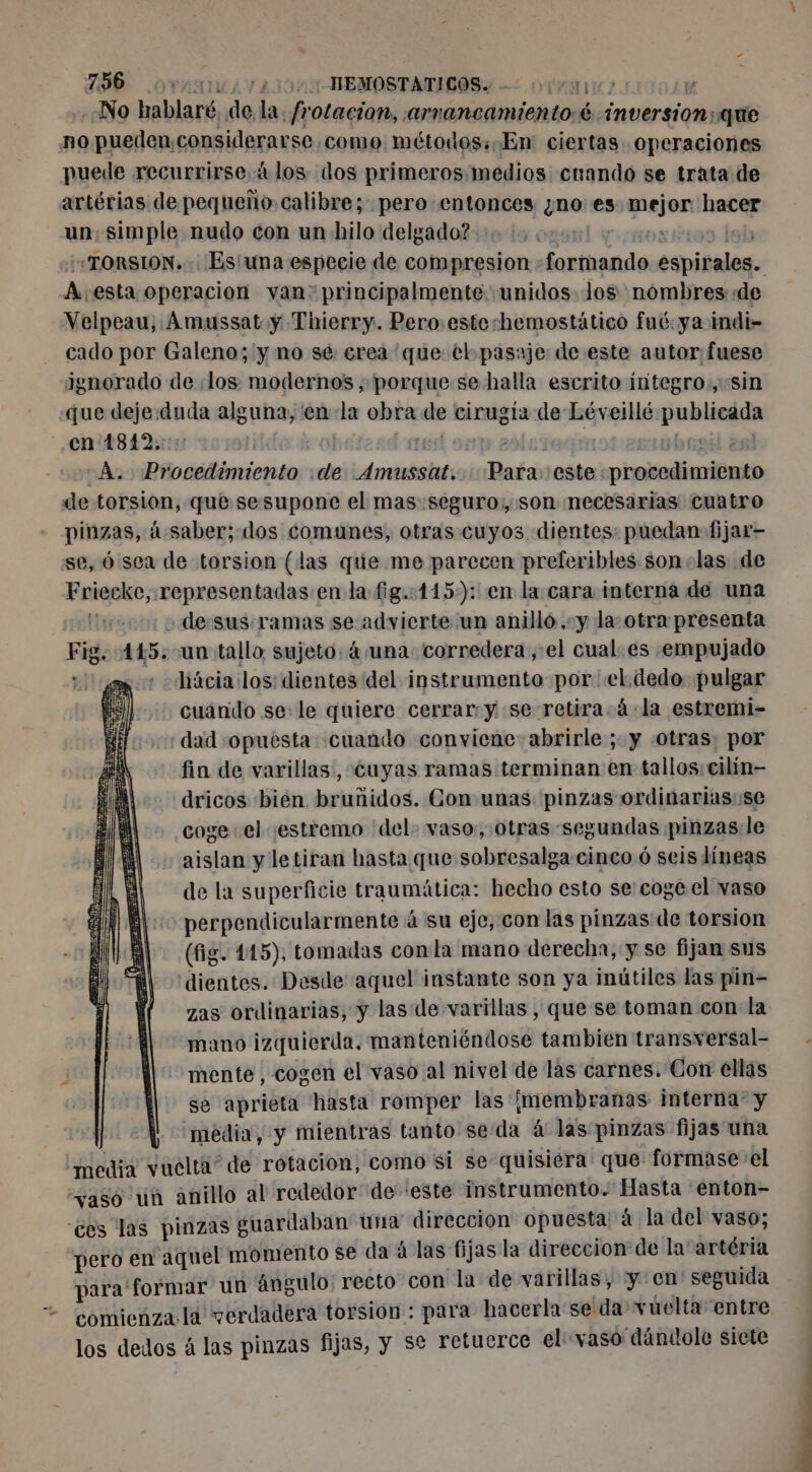 ys 756 or 21171 MEMOSTATICOS. - AMES t «No hablaré, de la. frotacion, arrancamiento:$ inversion: que no puedenconsiderarse como métodos: En: ciertas operaciones puede recurrirse à los dos primeros medios cuando se trata de artérias de pequeño. calibre; pero entonces ¿no es mejor hacer un: simple nudo con un hilo delgado? 4 13 ont aorios debo «TORSION.. Es'una especie de compresion -formando espirales. A esta operacion van: principalmente unidos Jos nombres «de Velpeau, Ámussat y Thierry. Pero. esteshemostático fué:ya indi- cado por Galeno; y no sé: erea que el pasaje de este autor:fuese Jgnorado de :los modernos ; porque se halla escrito integro., sin que deje:duda alguna, en la obra de cirugía de Léveillé publicada cn 1812.::: cobsizad asd op eal ciubrnid 281 A. Procedimiento :de Amussat. : Para: este procedimiento dle torsion, que sesupone el mas seguro, son necesarias cuatro pinzas, à saber; dos comunes, otras cuyos dientes: puedan fijar- se, ó sea de torsion (las que me parecen preferibles son «las de Friecke, representadas en la fig.:115:): en la cara interna de una el -de:sus:ramas se advierte un anillo ,-y la: otra presenta Fig. 445: un tallo sujeto: 4. una corredera, el cual. es empujado pl : -Jíácia los: dientes del instrumento por el.dedo pulgar cuándo se: le quiere cerrar:y se retira.á.la estremi- dad «opuesta cuando conviene abrirle ; y otras: por fin de varillas, cuyas ramas terminan en tallos: cilín- dricos bien bruñidos. Con unas pinzas ordinarias:se coge el estremo del. vaso, otras segundas pinzas le aislan y le tiran hasta que sobresalga-cinco 6 seis líneas de la superficie traumática: hecho esto se coge el vaso perpendicularmente á su eje, con las pinzas de torsion (fig. 445), tomadas con la mano derecha, y se fijan sus dientes. Desde aquel instante son ya inútiles las pin- zas ordinarias, y las de varillas, que se toman con la mano izquierda, manteniéndose tambien transversal- mente, cogen el vaso al nivel de las carnes. Con ellas se aprieta hasta romper las ¡membranas interna” y média, y mientras tanto seda 4'laspinzas fijas una media vuelta” de rotacion, como si se quisiera que formase el vaso un anillo al rededor' de este instrumento. Hasta enton- ces las pinzas guardaban una direccion opuesta à la del vaso; pero en aquel momento se da á las fijas la direccion de la: artéria para formar un ángulo: recto con la de varillas, y en seguida comienza la verdadera torsion : para hacerla se da vuelta: entre los dedos á las pinzas fijas, y se retuerce el vaso dándole siete = k a j NS PTS e - e === ERE Ma PEUR TIRE