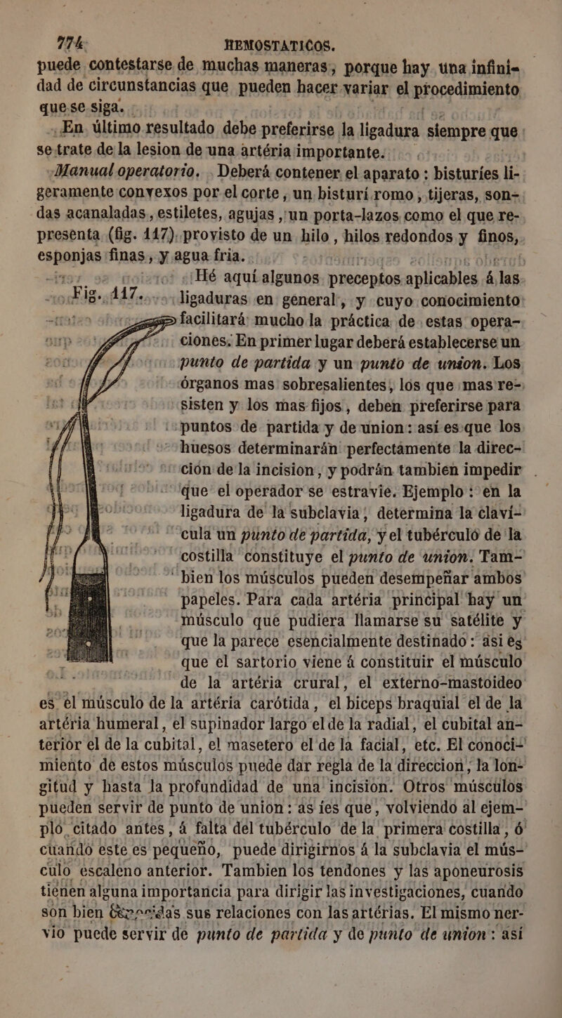 puede contestarse de muchas maneras, porque hay. una infini= dad de circunstancias que pueden hacer variar el prorgdiimiento quese siga. : : En último resultado debe preferirse la ligadura siempre que: se trate de la lesion de una artéria importante. «Manual operatorio. . Deberá contener el aparato : bisturies li- geramente conyexos por el corte, un bisturi.romo, tijeras, son=. das acanaladas, estiletes, agujas ,;'un porta-lazos como el que re- presenta (fig. 147). provisto de un hilo, hilos redondos y BR9B, CAE fines y agua fria. | -: Hé aqui “bas NS osé aplicables 4 las + Jigaduras en general, y cuyo conocimiento: facilitará: mucho la práctica de estas opera- ciones, En primer lugar deberá establecerse un punto de partida y un punto de union. Los «Órganos mas sobresalientes, lós que mas re=: “sisten y los mas fijos, deben preferirse para ¿puntos de partida y de union: así es.que los huesos determinarán perfectamente la direc- ción de la incision, y podrán tambien impedir . que el operador se estravie. Ejemplo : en la ligadura de la subclavia, determina la claví- -cula un punto de partida, yel tubérculo dela “costilla constituye el punto de union. Tam- “bien los músculos pueden desempeñar ambos papeles. Para cada artéria principal hay un músculo que pudiera llamarse su satélite y ‘que la parece esencialmente destinado : asi es que el sartorio viene 4 constituir el músculo de la artéria crural, el externo-mastoideo es el músculo de la artéria carótida, el Biceps braquial el de la artéria humeral, el supinador largo el de la radial, el cubital an- terior el de la cubital, el masetero el de la facial, etc. El conoci- miento de estos másculós puede dar regla de la direccion, la lon- gitud y hasta la profundidad de una incision. Otros músculos pueden servir de punto de union : as ies que, volviendo al ejem- plo citado antes, á falta del tubérculo de la primera costilla, 6 cuando este es pequeño, puede dirigirnos 4 la subclavia el is culo escaleno anterior. Tambien los tendones y las aponeurosis tiénen alguna importancia para dirigir las inv estigaciones, cuando son bien Cerpcidas sus relaciones con las artérias. El mismo ner- vio puede servir de punto de partida y de punto de union: asi