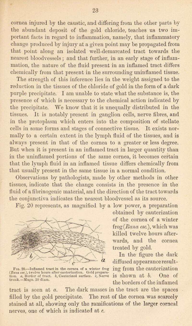 cornea injured by the caustic, and differing from the other parts by the abundant deposit of the gold chloride, teaches us two im¬ portant facts in regard to inflammation, namely, that inflammatory change produced by injury at a given point may be propagated from that point along an isolated well-demarcated tract towards the nearest bloodvessels ; and that further, in an early stage of inflam¬ mation, the nature of the fluid present in an inflamed tract differs chemically from that present in the surrounding uninflamed tissue. The strength of this inference lies in the weight assigned to the reduction in the tissues of the chloride of gold in the form of a dark purple precipitate. I am unable to state what the substance is, the presence of which is necessary to the chemical action indicated by the precipitate. We know that it is unequally distributed in the tissues. It is notably present in ganglion cells, nerve fibres, and in the protoplasm which enters into the composition of stellate cells in some forms and stages of connective tissue. It exists nor¬ mally to a certain extent in the lymph fluid of the tissues, and is always present in that of the cornea to a greater or less degree. But when it is present in an inflamed tract in larger quantity than in the uninflamed portions of the same cornea, it becomes certain that the lymph fluid in an inflamed tissue differs chemically from that usually present in the same tissue in a normal condition. Observations by pathologists, made by other methods in other tissues, indicate that the change consists in the presence in the fluid of a fibrinogenic material, and the direction of the tract towards the conjunctiva indicates the nearest bloodvessel as its source. Fig. 20 represents, as magnified by a low power, a preparation obtained by cauterization of dhe cornea of a winter frog (Bana esc.), which was killed twelve hours after¬ wards, and the cornea treated by gold. In the figure the dark diffused appearance result- Fig. 20.—Inflamed tract in the cornea of a winter frog illSf fl’Om the Cauterization o is shown at b. One of the borders of the inflamed tract is seen at a. The dark masses in the tract are the spaces filled by the gold precipitate. The rest of the cornea was scarcely stained at all, showing only the ramifications of the larger corneal nerves, one of which is indicated at c. (Ttana esc.), twelve hours after cauterization. Gold prepara¬ tion. a, Border of tract, b, Cauterized surface, c, Nerve trunk.—Magn. 50 diam.