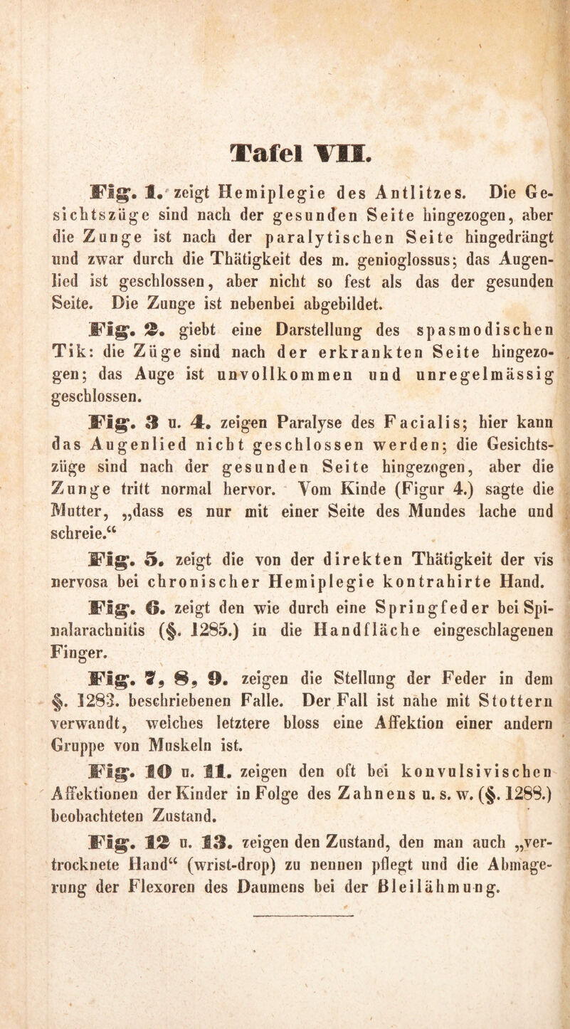 Tafel TU. Fig. 1# zeigt Hemiplegie des Antlitzes. Die Ge- sichtszüge sind nach der gesunden Seite hingezogen, aber die Zunge ist nach der paralytischen Seite hingedrängt und zwar durch die Thätigkeit des m. genioglossus; das Augen- lied ist geschlossen, aber nicht so fest als das der gesunden Seite. Die Zunge ist nebenbei ahgebildet. Fig. 0. giebt eine Darstellung des spasmodischen Tik: die Züge sind nach der erkrankten Seite hingezo- gen; das Auge ist unvollkommen und unregelmässig geschlossen. Fig*. 3 u. 4. zeigen Paralyse des Facialis; hier kann das Augenlied nicht geschlossen werden; die Gesichts- züge sind nach der gesunden Seite hingezogen, aber die Zunge tritt normal hervor. Vom Kinde (Figur 4.) sagte die Mutter, „dass es nur mit einer Seite des Mundes lache und schreie.“ Flg. 5. zeigt die von der direkten Thätigkeit der vis nervosa bei chronischer Hemiplegie kontrahirte Hand. Fig. 9. zeigt den wie durch eine Springfeder bei Spi- nalarachnitis (§. 1285.) in die Handfläche eingeschlagenen Finger. Flg. Vf 9. zeigen die Stellung der Feder in dem §. 1283. beschriebenen Falle. Der Fall ist nahe mit Stottern verwandt, welches letztere bloss eine Affektion einer andern Gruppe von Muskeln ist. Flg. 19 u. 11. zeigen den oft bei konvulsivischen Affektionen der Kinder in Folge des Zahnens u. s. w. (§. 1288.) beobachteten Zustand. Fig. 1J& u. 13. zeigen den Zustand, den man auch „ver- trocknete Hand“ (wrist-drop) zu nennen pflegt und die Abmage- rung der Flexoren des Daumens bei der ßleilähmung.