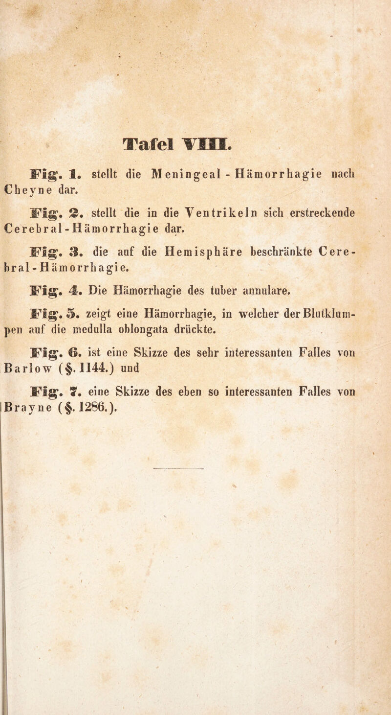 4. Waffel i ’ 11H. Mg. 1. stellt die Meningeal - Hämorrhagie nach Cheyne dar. Fig. stellt die in die Ventrikeln sich erstreckende Cerebral - Hämorrhagie dar. Mg. 3. die auf die Hemisphäre beschränkte Cere- bral-Hämorrhagie. Fig. 4-. Die Hämorrhagie des tuber annulare. Fig. 5. zeigt eine Hämorrhagie, in welcher der Blutklum- pen auf die medulla oblongata drückte. Fig. €1. ist eine Skizze des sehr interessanten Falles von Barlow (§.1144.) und Fig. S. eine Skizze des eben so interessanten Falles von Brayne (§. 1286,).