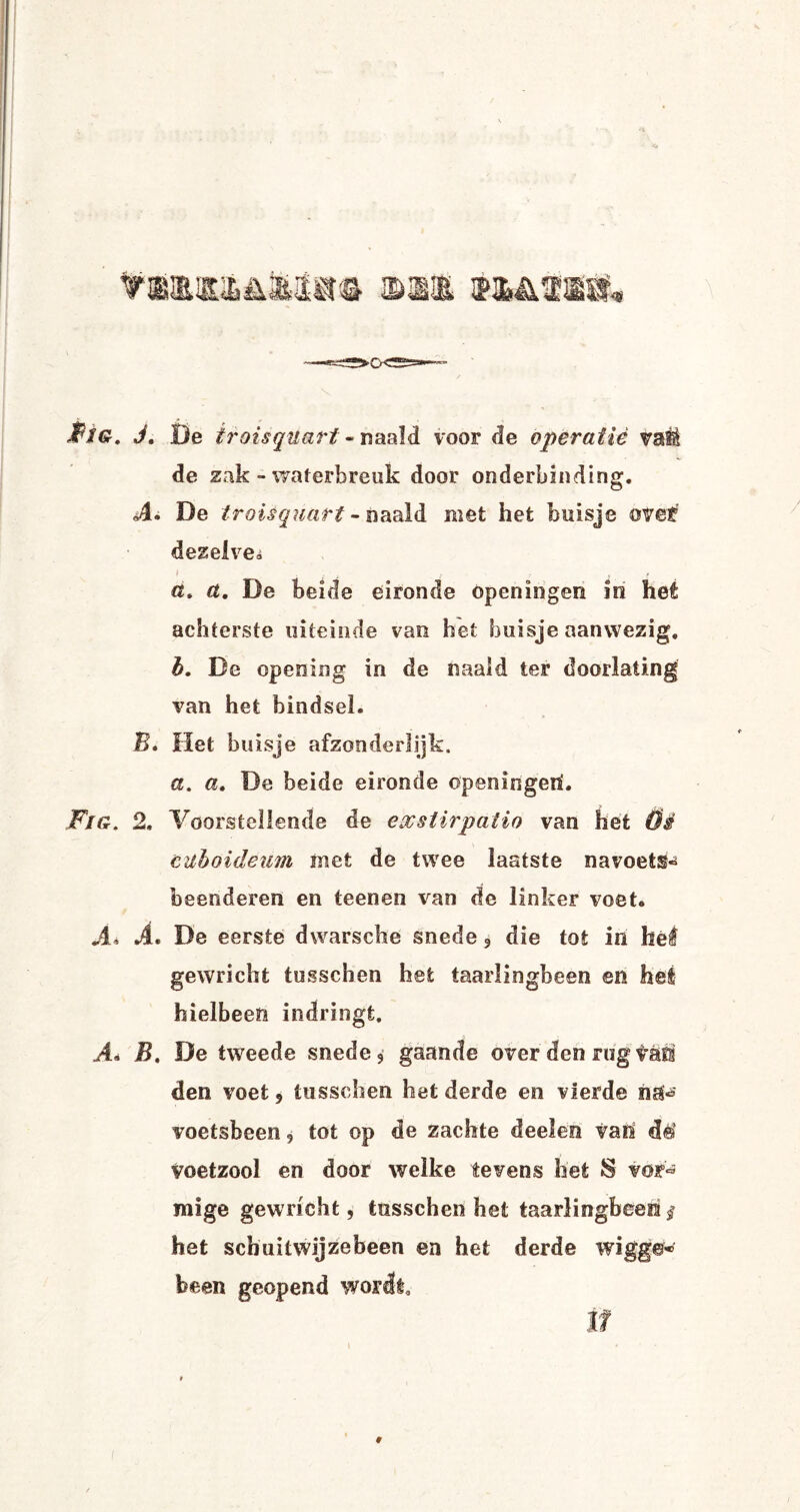 Fig. J. De iroisqiiart - naald voor de operatie vatÉ de zak - waterbreuk door onderbinding. A» De troisquart - naald met het buisje ovef' dezelve* (t. De beide eironde openiogen in het achterste uiteinde van het buisje aanwezig. b. De opening in de naald ter doorlating van het bindsel. E. Het buisje afzonderlijk. a. a. De beide eironde openingeni. Fig. 2, Voorstellende de exsiirpatio van het Öé citboideum met de twee laatste navoet$« beenderen en teenen van de linker voet. Ai A. De eerste dwarsche snede, die tot in hel gewricht tusschen het taarlingbeen en hel bielbeen indringt. A» B. De tweede snede, gaande over den rug taai den voet , tusschen het derde en vierde iiak voetsbeen 9 tot op de zachte deel en van de voetzool en door welke tevens het $ vor'« mige gewricht, tusschen het taarlingbeen § het sch uitwijze been en het derde wigge-® been geopend wordt, tl
