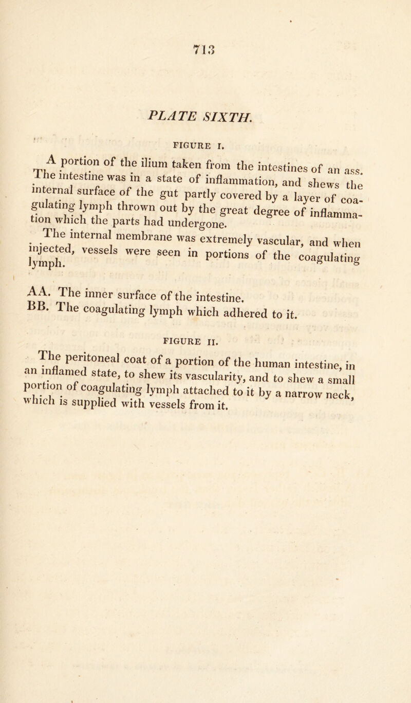 PLATE SIXTH. figure I. A portion of the ilium taken from the intestines of an ass. e intestine was in a state of inflammation, and shews the internal surface of the gut partly covered by a layer of coa- gulatmg- lymph thrown out by the great degree of inflamma- tion which the parts had undergone. The internal membrane was extremely vascular, and when lymph.'1’ V6SSe S WCre See” P°rti0nS °f the coaSl|hiting A A. The inner surface of the intestine. BB. The coagulating lymph which adhered to it. FIGURE II. The peritoneal coat of a portion of the human intestine, in an inflamed state, to shew its vascularity, and to shew a small poi tion of coagulating lymph attached to it by a narrow neck which is supplied with vessels from it. ’