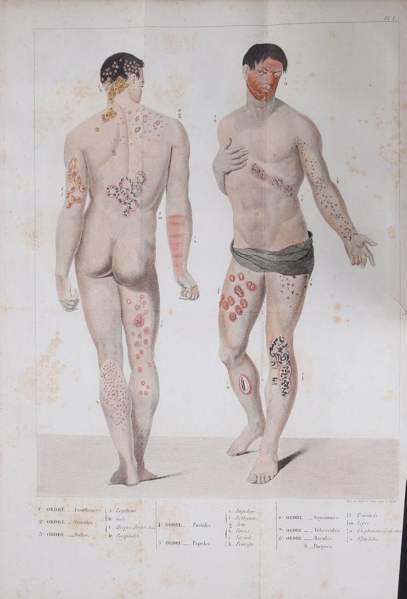 ORDRE = _lxantlicmes. — Meules . Bulles. D h. /4our. li role. 12777728 6! ORDRE Souammes. 7! ORDRE == Tubereules 8 ORDRE == Macules. NX =Purpura dr | Panne lee area | IL. Lioruccs ’ Li. Zopre à Dhantorr re | 0. Zpléldes .