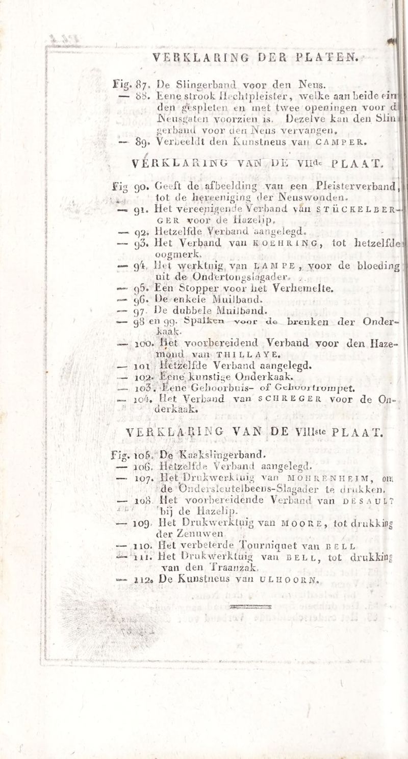 ] 4- v* V. VERKLARING OER PLATEN. 0 lig. 87, Oe Slingerband voor den Neos. . — 88. Eene strook Hechtpleister, welke aan beide ein den gespleten tu met twee opewingen voor d| Neusgaten voorzien is. Dezelve kan den Slin geiband voor tien Neus vervangen, — 89. Verbeeldt den Kunstneus van camper. VE Pk KLAR. ING VAN DE Vü^c p L A A T. Fi<v ■* o 9°. 91* q‘2, (j3. 94- 96. 9G. 97- Geeft de afbeelding van een Pleisterverband, tot de hereeniging der Neuswonden. liet vereenigende Verband van stückelber- ger voor de Hazelip. Hetzelfde Verband aangelegd, liet Verband van koehring, tot lietzelfde oogmerk. liet, werktuig van lampe, voor de bloeding uit de Ond’ertongslagader. , Een Stopper voor liet Verhemelte. Oe enkele Muilband. De dubbele Muilband. 98 en 99. Spalken -voor do breuken der Onder¬ kaak- 100. liet voorbereidend Verband voor den Iiaze- rrro.ud van thillaye, 101 lietzelfde Verband aangelegd. 102. Eene’kunstige Onderkaak. 103. Eene Gehoorbuis- of Ceiruui-fixuupet. jo4. Het Verband van sch reger voor de On¬ derkaak. VERKLARING VAN DE Vlllsie PLAAT. Fig. 10K De Kaakslingërband. — 106. Hetzelfde Verband aangelegd. — 107. Het Drukwerk.uig van moh re nh f,im, om de Ondersleutelbeens-Slagader te o rukken. — 100 Het voorbereidende Verband van desaüLT bij de Hazelip. — 109. Het Drukwerktuig van moore, tot drukking der Zenuwen — 110. Het verbeterde Tourniquet van bell — 111. Het Drukwerktuig van bell, tot drukking van den Traanzak, — 212# De Kunstneus van uthoorjv. * % ■ ' A y ' f-V ■ ■ ■ t$. „V j '•A' WN’ -f