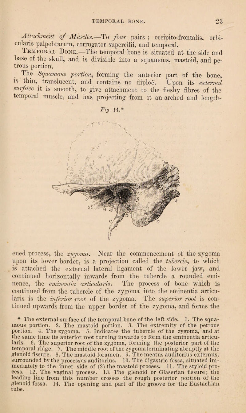 LJ O Attachment of Muscles.—To four pairs ; occipito-frontalis, orbi¬ cularis palpebrarum, corrugator supercilii, and temporal. Temporal Bone.—The temporal bone is situated at the side and base of the skull, and is divisible into a squamous, mastoid, and pe¬ trous portion. The Squamous portion, forming the anterior part of the bone, is thin,, translucent, and contains no diploe. Upon its external surface it is smooth, to give attachment to the fleshy fibres of the temporal muscle, and has projecting from it an arched and length- Fig. 14.# ened process, the zygoma. Near the commencement of the zygoma upon its lower border, is a projection called the tubercle, to which is attached the external lateral ligament of the lower jaw, and continued horizontally inwards from the tubercle a rounded emi¬ nence, the eminentia articularis. The process of bone which is continued from the tubercle of the zygoma into the eminentia articu¬ laris is the inferior root of the zygoma. The superior root is con¬ tinued upwards from the upper border of the zygoma, and forms the * The external surface of the temporal bone of the left side. 1. The squa¬ mous portion. 2. The mastoid portion. 3. The extremity of the petrous portion. 4. The zygoma. 5. Indicates the tubercle of the zygoma, and at the same time its anterior root turning inwards to form the eminentia articu¬ laris. 6. The superior root of the zygoma, forming the posterior part of the temporal ridge. 7. The middle root of the zygoma terminating abruptly at the glenoid fissure. 8. The mastoid foramen. 9. The meatus auditorius externus, surrounded by the processus auditorius. 10. The digastric fossa, situated im¬ mediately to the inner side of (2) the mastoid process. 11. The styloid pro¬ cess. 12. The vaginal process. 13. The glenoid or Glaserian fissure; the leading line from this number crosses the rough posterior portion of the glenoid fossa. 14. The opening and part of the groove for the Eustachian tube.