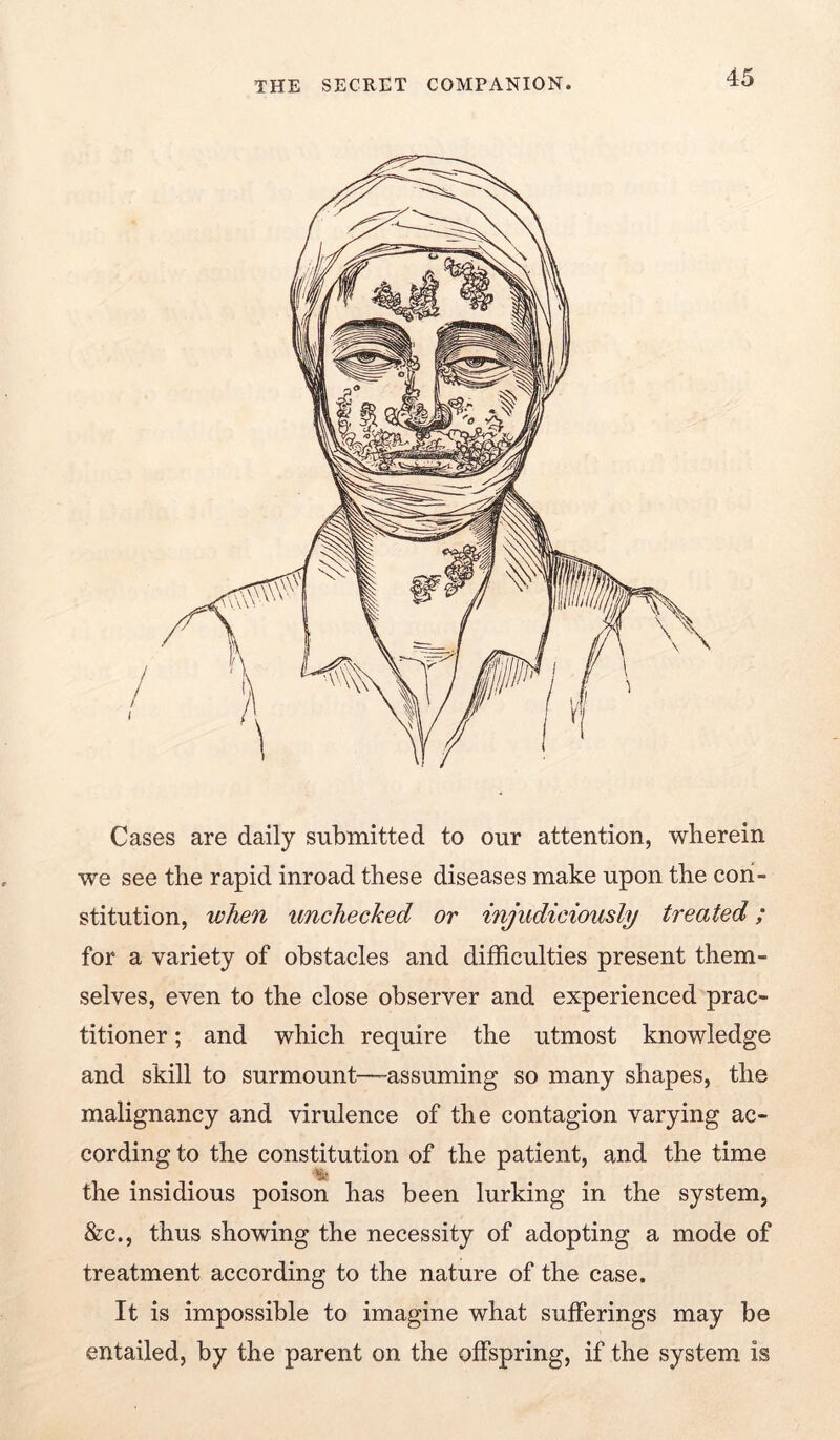 Cases are daily submitted to our attention, wherein we see the rapid inroad these diseases make upon the con- stitution, when unchecked or injudiciously treated; for a variety of obstacles and difficulties present them- selves, even to the close observer and experienced prac- titioner ; and which require the utmost knowledge and skill to surmount—assuming so many shapes, the malignancy and virulence of the contagion varying ac- cording to the constitution of the patient, and the time the insidious poison has been lurking in the system, &c., thus showing the necessity of adopting a mode of treatment according to the nature of the case. It is impossible to imagine what sufferings may be entailed, by the parent on the offspring, if the system is