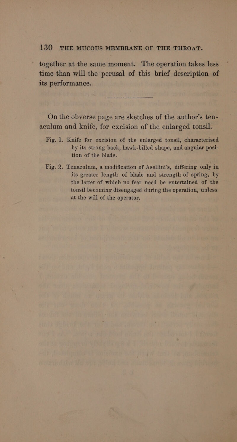 together at the same moment. The operation takes less time than will the perusal of this brief description of its performance. On the obverse page are sketches of the author’s ten- aculum and knife, for excision of the enlarged tonsil. Fig. 1. Knife for excision of the enlarged tonsil, characterised by its strong back, hawk-billed shape, and angular posi- tion of the blade. Fig. 2. Tenaculum, a modification of Asellini’s, differing only in its greater length of blade and strength of spring, by the latter of which no fear need be entertained of the tonsil becoming disengaged during the operation, unless at the will of the operator.