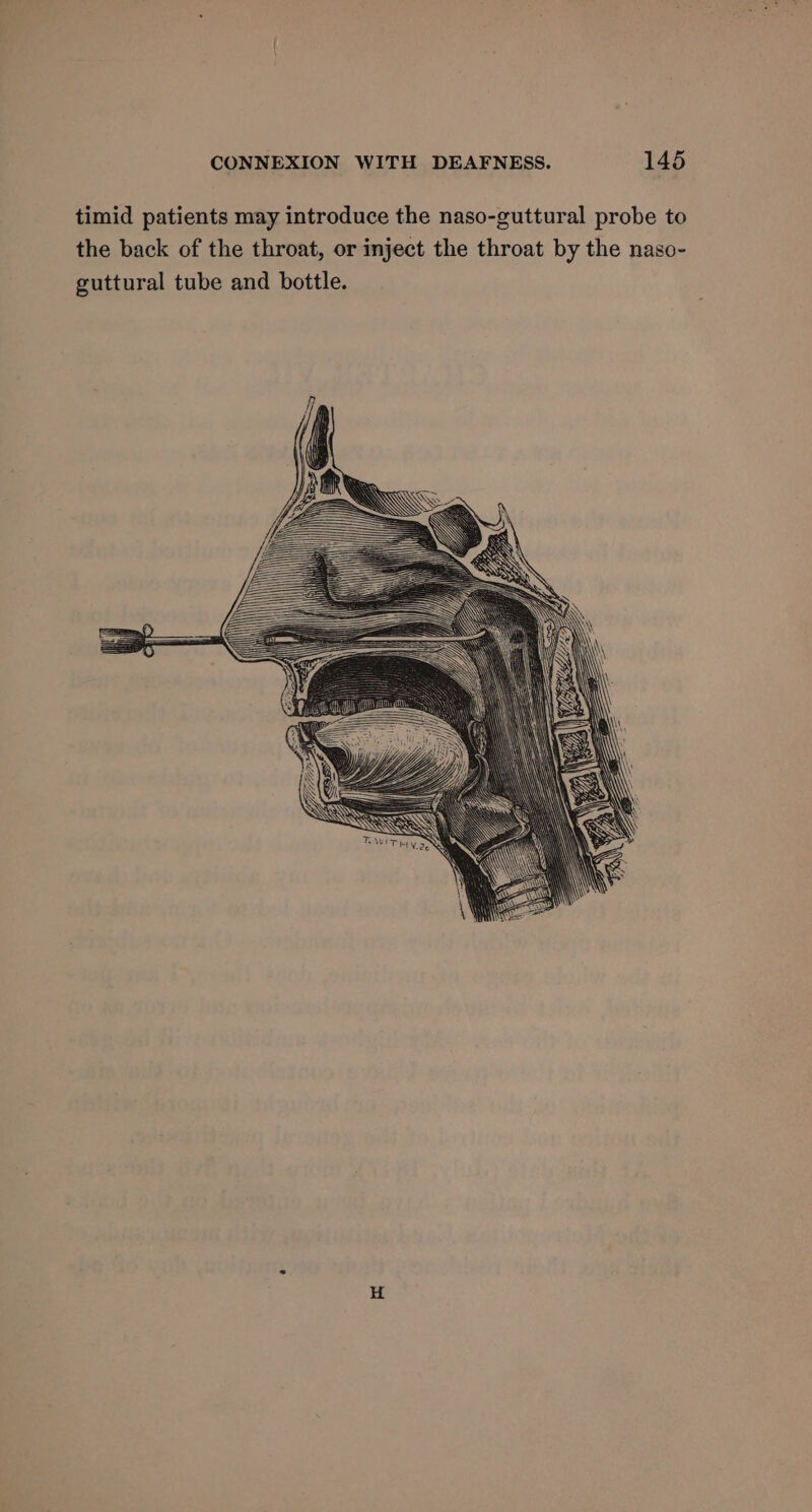 timid patients may introduce the naso-guttural probe to the back of the throat, or inject the throat by the naso- guttural tube and bottle.