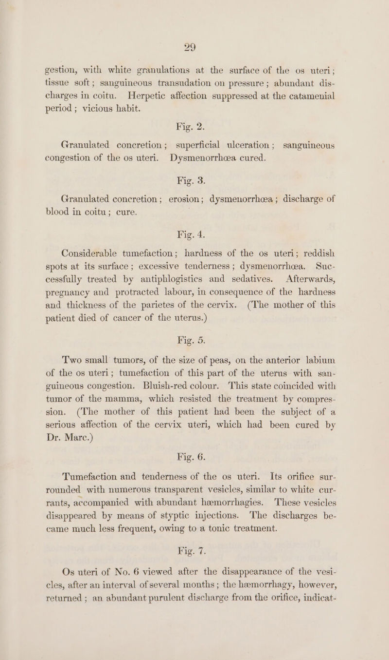 gestion, with white granulations at the surface of the os uteri; tissue soft; sanguineous transudation on pressure; abundant dis- charges in coitu. Herpetic affection suppressed at the catamenial period ; vicious habit. Fig. 2. Granulated concretion; superficial ulceration; sanguineous congestion of the os uteri. Dysmenorrhcea cured. Fig. 3. Granulated concretion; erosion; dysmenorrhea; discharge of blood in coitu; cure. | Fig. 4. Considerable tumefaction; hardness of the os uteri; reddish spots at its surface ; excessive tenderness ; dysmenorrhea. Suc- cessfully treated by antiphlogistics and sedatives. Afterwards, pregnancy and protracted labour, in consequence of the hardness and thickness of the parietes of the cervix. (The mother of this patient died of cancer of the uterus.) Fig. 5. Two small tumors, of the size of peas, on the anterior labium of the os uteri; tumefaction of this part of the uterus with san- guineous congestion. Bluish-red colour. This state coincided with tumor of the mamma, which resisted the treatment by compres- sion. (The mother of this patient had been the subject of a serious affection of the cervix uteri, which had been cured by Dr. Marc.) Fig. 6. Tumefaction and tenderness of the os uteri. Its orifice sur- rounded with numerous transparent vesicles, similar to white cur- rants, accompanied with abundant hemorrhagies. These vesicles disappeared by means of styptic injections. ‘The discharges be- came much less frequent, owing to a tonic treatment. ig. 7. Os uteri of No. 6 viewed after the disappearance of the vesi- cles, after an interval of several months ; the hæmorrhagy, however, returned ; an abundant purulent discharge from the orifice, indicat-