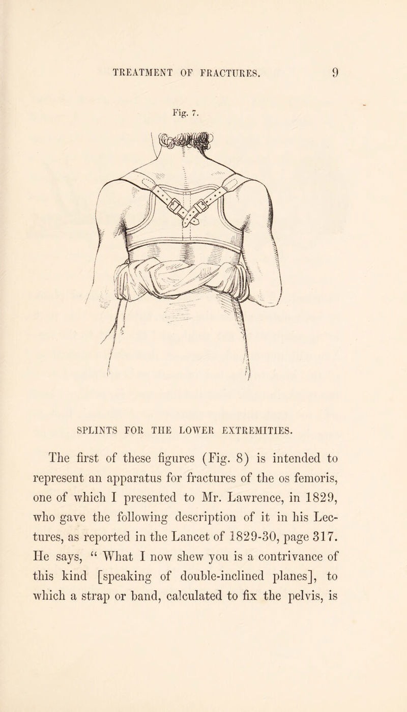 Fig. 7. SPLINTS FOR THE LOWER EXTREMITIES. The first of these figures (Fig. 8) is intended to represent an apparatus for fractures of the os femoris, one of which I presented to Mr. Lawrence, in 1829, who gave the following description of it in his Lec- tures, as reported in the Lancet of 1829-30, page 317. He says, “ What I now shew you is a contrivance of this kind [speaking of double-inclined planes], to which a strap or band, calculated to fix the pelvis, is