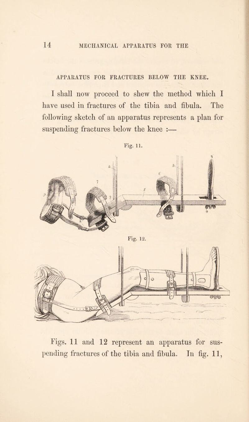 APPARATUS FOR FRACTURES BELOW THE KNEE. I shall now proceed to shew the method which I have used in fractures of the tibia and fibula. The following sketch of an apparatus represents a plan for suspending fractures below the knee :—- Fig. 11. Figs. 11 and 12 represent an apparatus for sus- pending fractures of the tibia and fibula. In fig. 11,