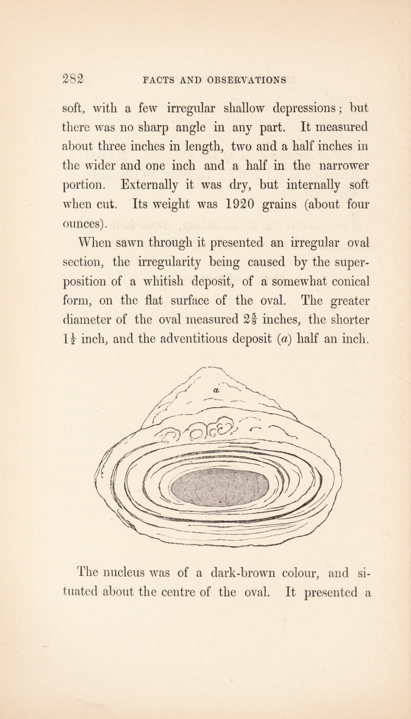 soft, with a few irregular shallow depressions; but there was no sharp angle in any part. It measured about three inches in length, two and a half inches in the wider and one inch and a half in the narrower portion. Externally it was dry, but internally soft when cut. Its weight was 1920 grains (about four ounces). When sawn through it presented an irregular oval section, the irregularity being caused by the super- position of a whitish deposit, of a somewhat conical form, on the flat surface of the oval. The greater diameter of the oval measured 2f inches, the shorter li inch, and the adventitious deposit (a) half an inch. The nucleus was of a dark-brown colour, and si- tuated about the centre of the oval. It presented a