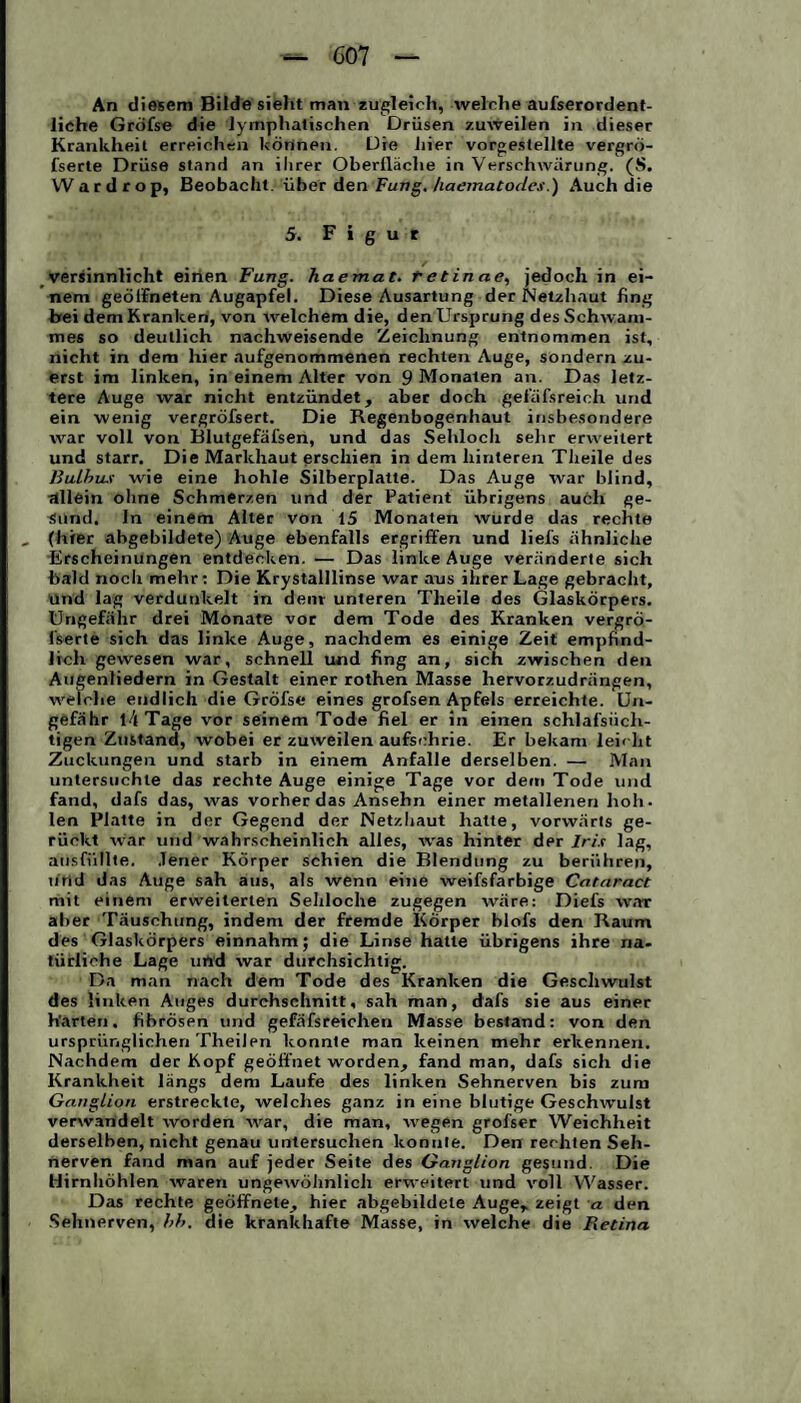 An diesem Bilde sieht man zugleich, welche aufserordent- liche Gröfse die lymphatischen Drüsen zuweilen in dieser Krankheit erreichen können. Die hier vorgestellte vergrö- fserte Drüse stand an ihrer Oberlläclie in Verschwärung. (8. Wardrop, Beobacht, über den Fung. haematodes.) Auch die 5. Figur versinnlicht einen Fung. haemat. retinae, jedoch in ei¬ nem geöffneten Augapfel. Diese Ausartung der Netzhaut fing bei dem Kranken, von welchem die, den Ursprung des Schwam¬ mes so deutlich nachweisende Zeichnung entnommen ist, nicht in dem hier aufgenommenen rechten Auge, sondern zu¬ erst im linken, in einem Alter von 9 Monaten an. Das letz¬ tere Auge war nicht entzündet, aber doch gefäfsreich und ein wenig vergröfsert. Die Regenbogenhaut insbesondere war voll von Blutgefäfsen, und das Sehloch sehr erweitert und starr. Die Markhaut erschien in dem hinteren Theile des liulhus wie eine hohle Silberplalte. Das Auge war blind, allein ohne Schmerzen und der Patient übrigens auch ge¬ sund. ln einem Alter von 15 Monaten wurde das rechte (hier abgebildete) Auge ebenfalls ergriffen und liefs ähnliche Erscheinungen entdecken. — Das linke Auge veränderte sich bald noch mehr: Die Krystalllinse war aus ihrer Lage gebracht, und lag verdunkelt in dem unteren Theile des Glaskörpers. Ungefähr drei Monate vor dem Tode des Kranken vergrö- l'serte sich das linke Auge, nachdem es einige Zeit empfind¬ lich gewesen war, schnell und fing an, sich zwischen den Augenliedern in Gestalt einer rothen Masse hervorzudrängen, welche endlich die Gröfse eines grofsen Apfels erreichte. Un¬ gefähr l4Tage vor seinem Tode fiel er in einen schlafsüch¬ tigen Zustand, wobei er zuweilen aufschrie. Er bekam leicht Zuckungen und starb in einem Anfalle derselben. — Man untersuchte das rechte Auge einige Tage vor dem Tode und fand, dafs das, was vorherdas Ansehn einer metallenen hob- len Platte in der Gegend der Netzhaut hatte, vorwärts ge¬ rückt war und wahrscheinlich alles, was hinter der Iris lag, ausfüllte. Jener Körper schien die Blendung zu berühren, ütld das Auge sah aus, als wenn eine weifsfarbige Cataract mit einem erweiterten Sehloche zugegen wäre: Diefs war aber Täuschung, indem der fremde Körper blofs den Raum des Glaskörpers einnahm; die Linse hatte übrigens ihre na¬ türliche Lage und war durchsichtig. Da man nach dem Tode des Kranken die Geschwulst des linken Auges durchschnitt, sah man, dafs sie aus einer Karten, fibrösen und gefäfsreichen Masse bestand: von den ursprünglichen Theilen konnte man keinen mehr erkennen. Nachdem der Kopf geöffnet worden, fand man, dafs sich die Krankheit längs dem Laufe des linken Sehnerven bis zum Ganglion erstreckte, welches ganz in eine blutige Geschwulst verwandelt worden war, die man, wegen grofser Weichheit derselben, nicht genau untersuchen konnte. Den rechten Seh¬ nerven fand man auf jeder Seite des Ganglion gesund. Die Hirnhöhlen waren ungewöhnlich erweitert und voll Wasser. Das rechte geöffnete, hier abgebildete Auge, zeigt a den Sehnerven, hh. die krankhafte Masse, in welche die Retina