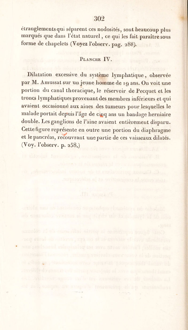 étranglements qui séparent ces nodosités, sont beaucoup plus marqués que dans l’état naturel, ce qui les fait paraître sous forme de chapelets (Voyez l’observ. pag. 288). Planche IV. Dilatation excessive du système lymphatique, observée par M. Amussat sur un jeune homme de 19 ans. On voit une portion du canal thoracique, le réservoir de Pecquet et les troncs lymphatiques provenant des membres inférieurs et qui avaient occasionné aux aines des tumeurs pour lesquelles le malade portait depuis l’âge de cyjq ans un bandage herniaire double. Les ganglions de l’aine avaient entièrement disparu. Cette figure représente en outre une portion du diaphragme et le pancréas, recouvrant une partie de ces vaisseaux dilatés» (Voy. l’observ. p. 258.)