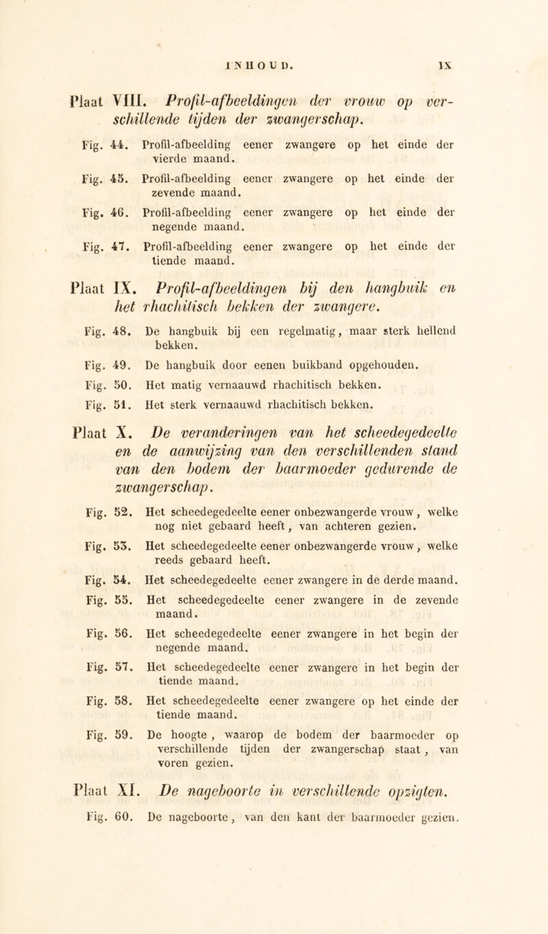 Plaat VflI. Profil-afbeeldingcn der vromv op ver- schillende tijden der zwangerschap. Fig. 44. Profil-afbeelding eener vierde maand. zwangere op het einde der Fig. 45. Profd-afbeelding eencr zevende maand. zwangere op het einde der Fig. 46. Profd-afbeelding eener negende maand. zwangere op het einde der Fig. 47. Profd-afbeelding eener tiende maand. zwangere op het einde der Plaat IX. Profil-afbeelding en bij den hangbuik en het rhachiiisch bekken der zwangere. Fig. 48, De hangbuik bij een regelmatig, maar sterk hellend bekken. Fig. 49. De hangbuik door eenen buikband opgehouden. Fig. 50. Het matig vernaauwd rhachitisch bekken. Fig. 51. Het sterk vernaauwd rhachitisch bekken. Plaat X. De veranderingen van het scheedegedeelte en de aanwijzing van den verschillenden stand van den bodem der baarmoeder gedurende de zwangerschap. Fig. 52. Fig. 53. Fig. 54. Fig. 55. Fig. 56. Fig. 57. Fig. 58. Fig. 59. Het scheedegedeelte eener onbezwangerde vrouw, welke nog niet gebaard heeft, van achteren gezien. Het scheedegedeelte eener onbezwangerde vrouw, welke reeds gebaard heeft. Het scheedegedeelte eener zwangere in de derde maand. Het scheedegedeelte eener zwangere in de zevende maand. Het scheedegedeelte eener zwangere in het begin der negende maand. Het scheedegedeelte eener zwangere in het begin der tiende maand. Het scheedegedeelte eener zwangere op het einde der tiende maand. De hoogte , waarop de bodem der baarmoeder op verschillende tijden der zwangerschap staat , van voren gezien. Plaat XL De nageboorte in verschillende opzigten. Fig. 60. De nageboorte , van den kant der baarmoeder gezien.