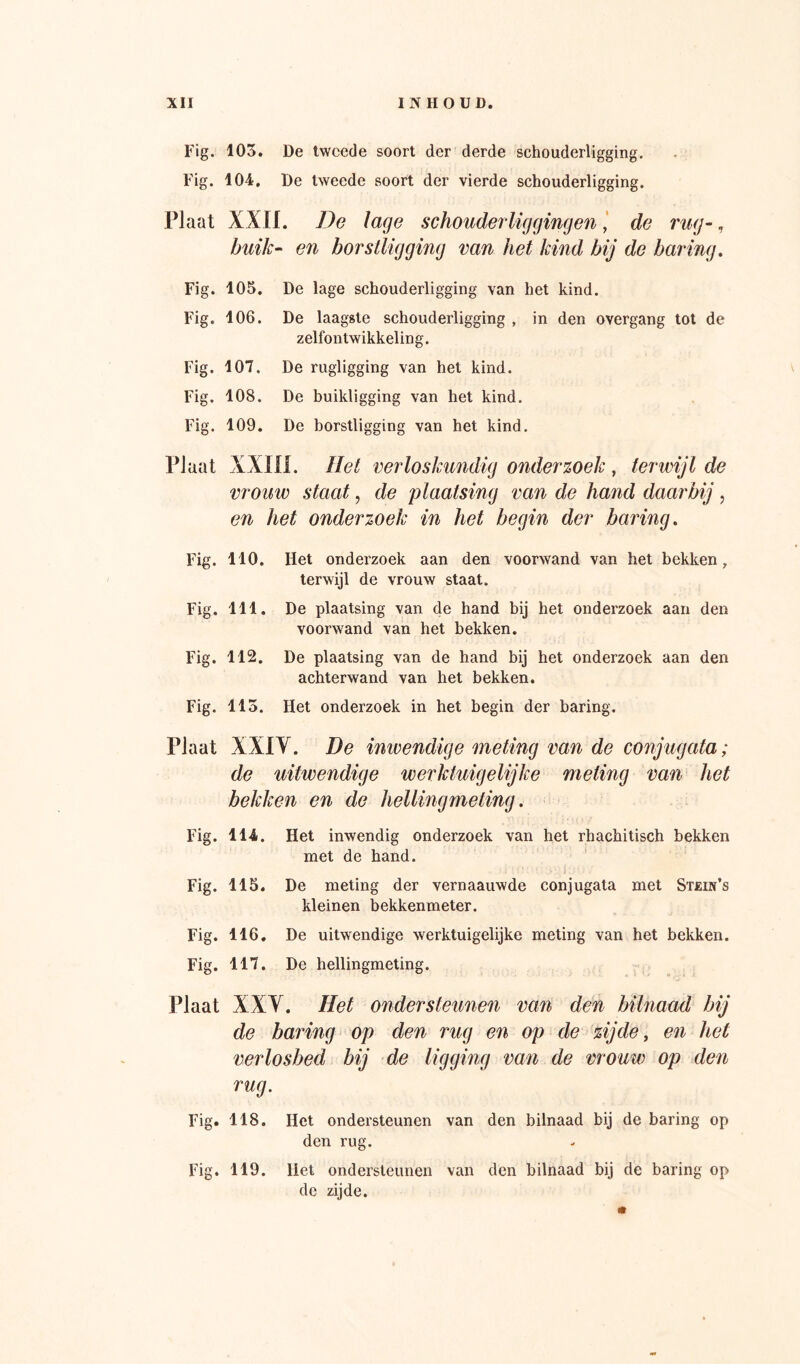 Fig. 105. De tweede soort der derde schouderligging. Fig. 104, De tweede soort der vierde schouderligging. Plaat XXIf. De lage schouderligging en ‘ de rug-, huik- en borstUgging van het kind bij de haring. Fig. 105, Fig. 106. Fig. 107. Fig. 108. Fig. 109. De lage schouderligging van het kind. De laagste schouderligging , in den overgang tot de zelfontwikkeling. De rugligging van het kind. De buikligging van het kind. De borstligging van het kind. Plaat XXni. Het verloskundig onderzoek, terwijl de vrouw staat, de plaatsing van de hand daarbij, en het onderzoek in het begin der haring. Fig. 110. Het onderzoek aan den voorwand van het bekken, terwijl de vrouw staat. Fig. 111. De plaatsing van de hand bij het onderzoek aan den voorwand van het bekken. Fig. 112. De plaatsing van de hand bij het onderzoek aan den achterwand van het bekken. Fig. 113. Het onderzoek in het begin der baring. Plaat XXIY. De inivendige meting van de conjugata; de uitwendige werktuigelijke meting van het bekken en de helling meting. Fig. 114. Het inwendig onderzoek van het rhachitisch bekken met de hand. Fig. 115. De meting der vernaauwde conjugata met Stein’s kleinen bekkenmeter. Fig. 116, De uitwendige werktuigelijke meting van het bekken. Fig. 117. De hellingmeting. Plaat XXY. Het ondersteunen van den bilnaad bij de baidng op den rug en op de zijde, en het verlosbed bij de ligging van de vrouw op den rug. Fig. 118. Het ondersteunen van den bilnaad bij de baring op den rug. Fig. 119. Het ondersteunen van den bilnaad bij de baring op de zijde.