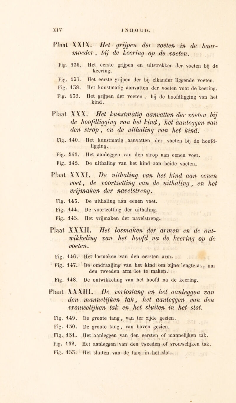 f^Jaat XXIX. Het grijpen der voêten in de baar- moeder , bij de keering op de voeten, Fig. 136. Het eerste grijpen en uitstrekken der voeten bij de keering. Fig. 137. Het eerste grijpen der bij elkander liggende voeten. Fig. 138. Het kunstmatig aanvatten der voeten voor de keering. Fig. 139. Het grijpen der voeten , bij de hoofdligging van het kind. Plaat XXX. Het kunstmatig aanvatten der voeten bij de hoofdligging van het kind, het aanleggen van den strop, en de uithaling van het kind, ^Ig. 140. Het kunstmatig aanvatten der voeten bij de hoofd- ligging. Fig. 141. Het aanleggen van den strop aan eenen voet. Fig. 142. De uithaling van het kind aan beide voeten. Plaat XXXI. De uithaling van het kind aan eenen voet, de voort%etting van de uithaling, en het vrijmaken der navelstreng, Fig. 143. De uithaling aan eenen voet. Fig. 144. De voortzetting der uithaling. Fig. 143. Het vrijmaken der navelstreng. Plaat XXXII. Het losmaken der armen en de ont- wikkeling van het hoofd na de keering op de voeten, Fig. 146. Het losmaken van den eersten arm. Fig. 147. De omdraaijing van het kind om zijne lengte-as, om den tweeden arm los te maken. Fig. 148. De ontwikkeling van het hoofd na de keering. Plaat XXXIII. De veidostang en het aanleggen van den 7nannelijken tak, het aanleggen van den vrouwelijken tak en het sluiten in het slot. Fig. 149. De groote tang, van ter zijde gezien. Fig. 150. De groote tang, van boven gezien. Fig. 151. Het aanleggen van den eersten of mannelijken tak. Fig. 152. Het aanleggen van den tweeden of vrouwelijken tak. Fig. 153. Het sluiten van de tang in het slot,