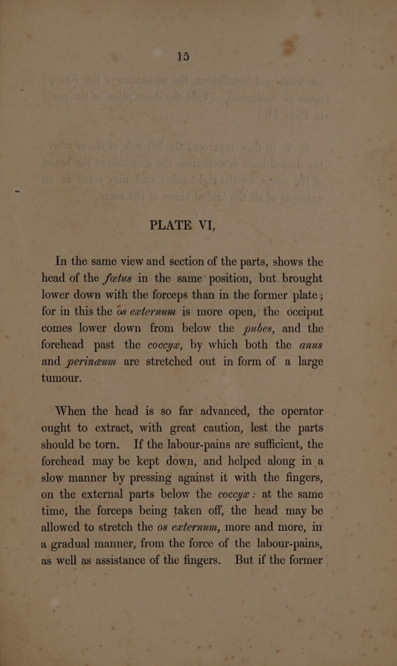 Bd 15 PLATE VI, In the same view and section of the parts, shows the head of the fetus in the same position, but. brought lower down with the forceps than in the former. plate ; for in this the os ewternum is more open, the occiput comes lower down from below the pwdées, and the forehead past the coccyx, by which both the anus and perineum are stretched out in form of a large tumour. When the head is so far advanced, the operator ought to extract, with great caution, lest the parts should be torn. If the labour-pains are sufficient, the forehead may be kept down, and helped along in a slow manner by pressing against it with the fingers, on the external parts below the coccyx: at the same time, the forceps being taken off, the head may be allowed to stretch the os externum, more and more, in a gradual manner, from the force of the labour-pains, as well as assistance of the fingers. But if the former