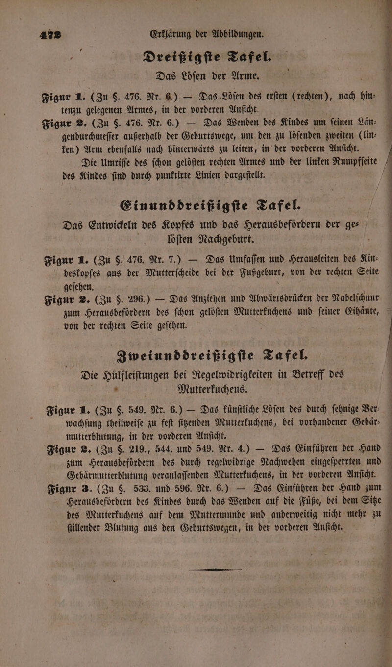 Dreifigite Tafel. Das Löſen der Arme. Figur 1. (Zu $. 476. Nr. 6.) — Das Lbſen des erſten (rechten), nach hin⸗ tenzu gelegenen Armes, in der vorderen Anſicht. Figur 2. (Zu 5. 476. Nr. 6.) — Das Wenden des Kindes um feinen Län⸗ gendurchmeſſer außerhalb der Geburtswege, um den zu löſenden zweiten (lin⸗ ken) Arm ebenfalls nach hinterwärts zu leiten, in der vorderen Anſicht. Die Umriſſe des ſchon gelöſten rechten Armes und der linken Rumpfſeite des Kindes find durch punktirte Linien dargeſtellt. Einunddreißigſte Tafel. Das Entwickeln des Kopfes und das Herausbefördern der ger | löſten Nachgeburt. f Figur 1. (Zu $. 476. Nr. 7 7.) — Das Umfaſſen und Herausleiten des Kin⸗ deskopfes aus der Mutterſcheide bei der Fußgeburt, von der rechten Seite geſehen. Figur 2. (Zu §. 296.) — Das Anziehen und Abwärtsdrücken der Nabelſchnur von der rechten Seite geſehen. Zweiunddreißigſte Tafel. Die eee bei Regelwidrigkeiten in Betreff des Mutterkuchens. Figur 1. (Zu S. 549. Nr. 6.) — Das künſtliche Löſen des durch ſehnige Ver⸗ wachſung theilweiſe zu feſt ſitzenden Mutterkuchens, bei vorhandener Gebär⸗ mutterblutung, in der vorderen Anſicht. Figur 2. (Zu 5. 219., 544. und 549. Nr. 4.) — Das Einführen der Hand zum Herausbefördern des durch regelwidrige Nachwehen eingeſperrten und Gebärmutterblutung veranlaſſenden Mutterkuchens, in der vorderen Anſicht. Figur 3. (Zu $. 533. und 596. Nr. 6.) — Das Einführen der Hand zum des Mutterkuchens auf dem Muttermunde und anderweitig nicht mehr zu ſtillender Blutung aus den Geburtswegen, in der vorderen Anſicht.