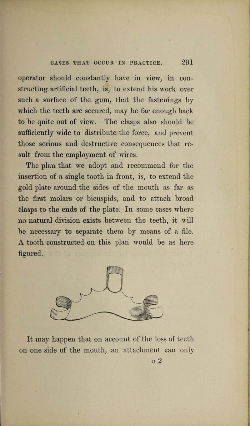 operator should constantly have in view, in con¬ structing artificial teeth, is, to extend his work over such a surface of the gum, that the fastenings by which the teeth are secured, may be far enough back to be quite out of view. The clasps also should be sufficiently wide to distribute the force, and prevent those serious and destructive consequences that re¬ sult from the employment of wires. The plan that we adopt and recommend for the insertion of a single tooth in front, is, to extend the gold plate around the sides of the mouth as far as the first molars or bicuspids, and to attach broad Clasps to the ends of the plate. In some cases where no natural division exists between the teeth, it will be necessary to separate them by means of a file. A tooth constructed on this plan would be as here figured. It may happen that on account of the loss of teeth on one side of the mouth, an attachment can only o 2