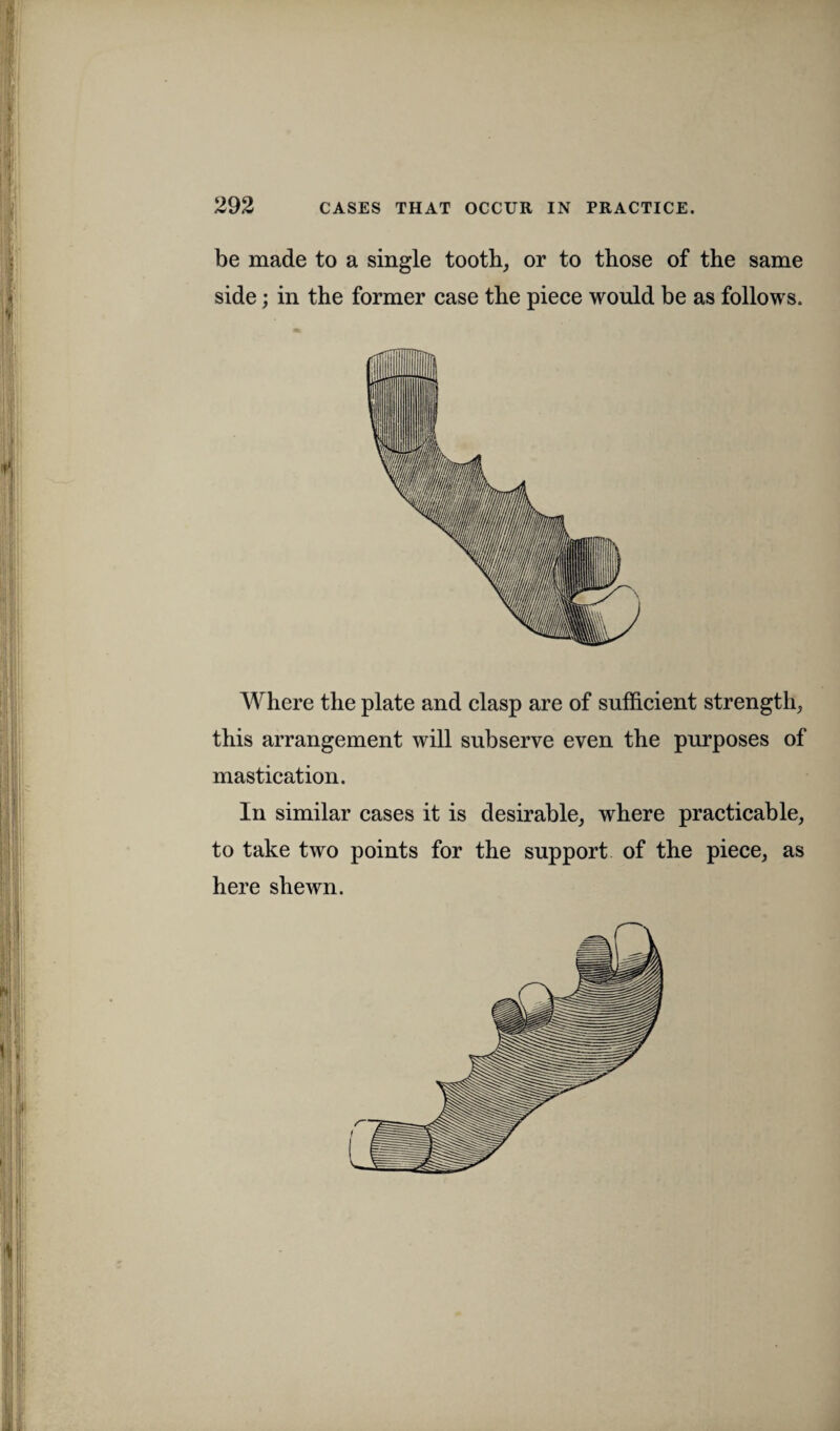 be made to a single tooth, or to those of the same side; in the former case the piece would be as follows. Where the plate and clasp are of sufficient strength, this arrangement will subserve even the purposes of mastication. In similar cases it is desirable, where practicable, to take two points for the support of the piece, as here shewn.