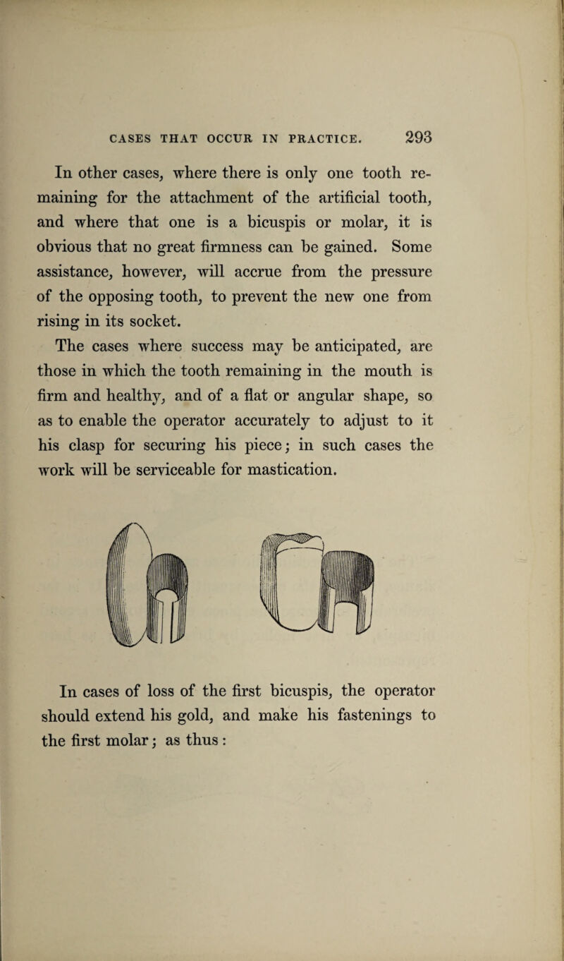 In other cases, where there is only one tooth re¬ maining for the attachment of the artificial tooth, and where that one is a bicuspis or molar, it is obvious that no great firmness can be gained. Some assistance, however, will accrue from the pressure of the opposing tooth, to prevent the new one from rising in its socket. The cases where success may be anticipated, are those in which the tooth remaining in the mouth is firm and healthy, and of a flat or angular shape, so as to enable the operator accurately to adjust to it his clasp for securing his piece; in such cases the work will be serviceable for mastication. In cases of loss of the first bicuspis, the operator should extend his gold, and make his fastenings to the first molar; as thus :