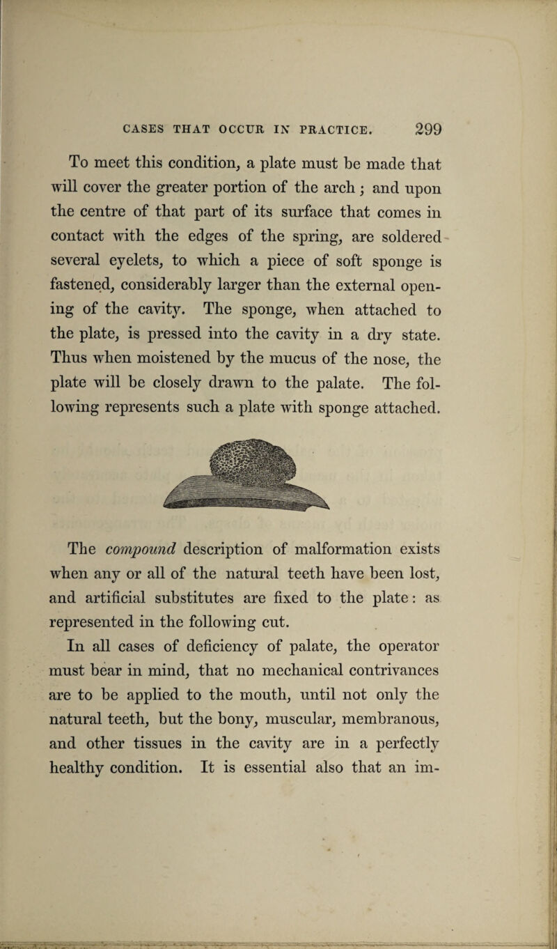 To meet this condition, a plate must be made that will cover the greater portion of the arch ; and upon the centre of that part of its surface that comes in contact with the edges of the spring, are soldered several eyelets, to which a piece of soft sponge is fastened, considerably larger than the external open¬ ing of the cavity. The sponge, when attached to the plate, is pressed into the cavity in a dry state. Thus when moistened by the mucus of the nose, the plate will be closely drawn to the palate. The fol¬ lowing represents such a plate with sponge attached. The compound description of malformation exists when any or all of the natural teeth have been lost, and artificial substitutes are fixed to the plate: as represented in the following cut. In all cases of deficiency of palate, the operator must bear in mind, that no mechanical contrivances are to be applied to the mouth, until not only the natural teeth, but the bony, muscular, membranous, and other tissues in the cavity are in a perfectly healthy condition. It is essential also that an im-