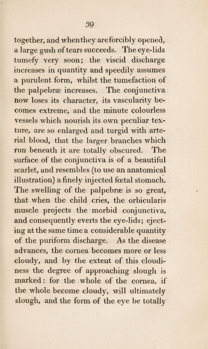 together, and when they are forcibly opened, a large gush of tears succeeds. The eye-lids tumefy very soon; the viscid discharge increases in quantity and speedily assumes a purulent form, whilst the tumefaction of the palpebrse increases. The conjunctiva now loses its character, its vascularity be¬ comes extreme, and the minute colourless vessels which nourish its own peculiar tex¬ ture, are so enlarged and turgid with arte¬ rial blood, that the larger branches which run beneath it are totally obscured. The surface of the conjunctiva is of a beautiful scarlet, and resembles (to use an anatomical * illustration) a finely injected foetal stomach. The swelling of the palpebrse is so great, that when the child cries, the orbicularis muscle projects the morbid conjunctiva, and consequently everts the eye-lids; eject¬ ing at the same time a considerable quantity of the puriform discharge. As the disease advances, the cornea becomes more or less cloudy, and by the extent of this cloudi¬ ness the degree of approaching slough is marked: for the whole of the cornea, if the whole become cloudy, will ultimately slough, and the form of the eye be totally