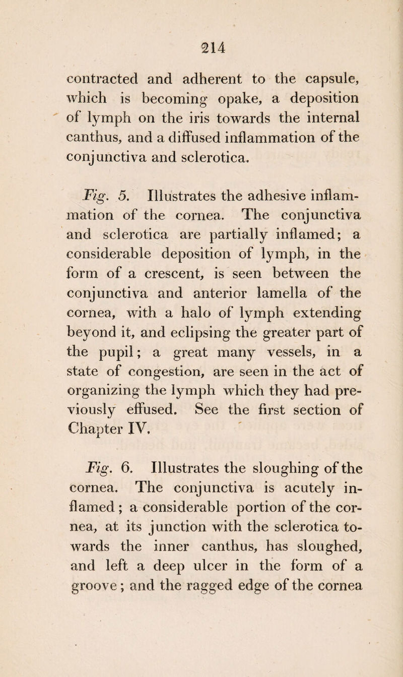contracted and adherent to the capsule, which is becoming opake, a deposition of lymph on the iris towards the internal canthus, and a diffused inflammation of the conjunctiva and sclerotica. Fig. 5. Illustrates the adhesive inflam¬ mation of the cornea. The conjunctiva and sclerotica are partially inflamed; a considerable deposition of lymph, in the form of a crescent, is seen between the conjunctiva and anterior lamella of the cornea, with a halo of lymph extending beyond it, and eclipsing the greater part of the pupil; a great many vessels, in a state of congestion, are seen in the act of organizing the lymph which they had pre¬ viously effused. See the first section of Chapter IV. Fig. 6. Illustrates the sloughing of the cornea. The conjunctiva is acutely in¬ flamed ; a considerable portion of the cor¬ nea, at its junction with the sclerotica to¬ wards the inner canthus, has sloughed, and left a deep ulcer in the form of a groove; and the ragged edge of the cornea