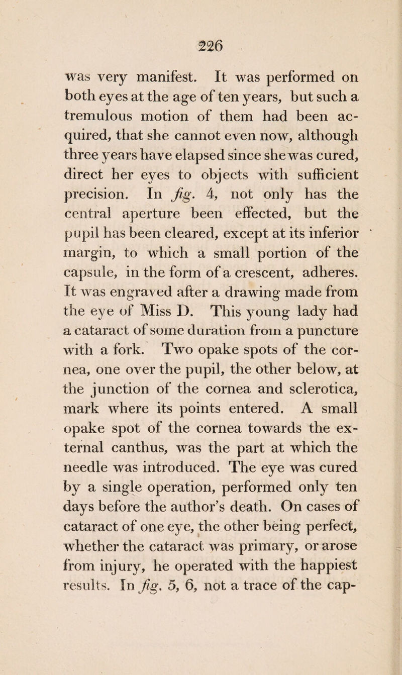 was very manifest. It was performed on both eyes at the age of ten years, but such a tremulous motion of them had been ac¬ quired, that she cannot even now, although three years have elapsed since she was cured, direct her eyes to objects with sufficient precision. In fig. 4, not only has the central aperture been effected, but the pupil has been cleared, except at its inferior ' margin, to which a small portion of the capsule, in the form of a crescent, adheres. It was engraved after a drawing made from the eye of Miss D. This young lady had a cataract of some duration from a puncture with a fork. Two opake spots of the cor¬ nea, one over the pupil, the other below, at the junction of the cornea and sclerotica, mark where its points entered. A small opake spot of the cornea towards the ex¬ ternal canthus, was the part at which the needle was introduced. The eye was cured by a single operation, performed only ten days before the author’s death. On cases of cataract of one eye, the other being perfect, whether the cataract was primary, or arose from injury, he operated with the happiest results. In fig. 5, 6, not a trace of the cap-