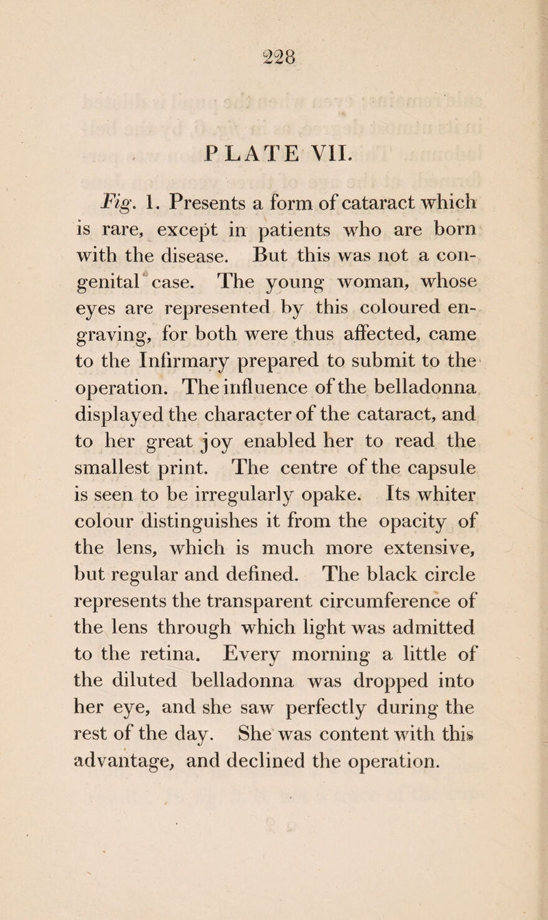 PLATE V1L Fig. 1. Presents a form of cataract which is rare, except in patients who are born with the disease. But this was not a con¬ genital case. The young woman, whose eyes are represented by this coloured en¬ graving, for both were thus affected, came to the Infirmary prepared to submit to the operation. The influence of the belladonna displayed the character of the cataract, and to her great joy enabled her to read the smallest print. The centre of the capsule is seen to be irregularly opake. Its whiter colour distinguishes it from the opacity of the lens, which is much more extensive, but regular and defined. The black circle represents the transparent circumference of the lens through which light was admitted to the retina. Every morning a little of the diluted belladonna was dropped into her eye, and she saw perfectly during the rest of the day. She was content with this » r advantage, and declined the operation.