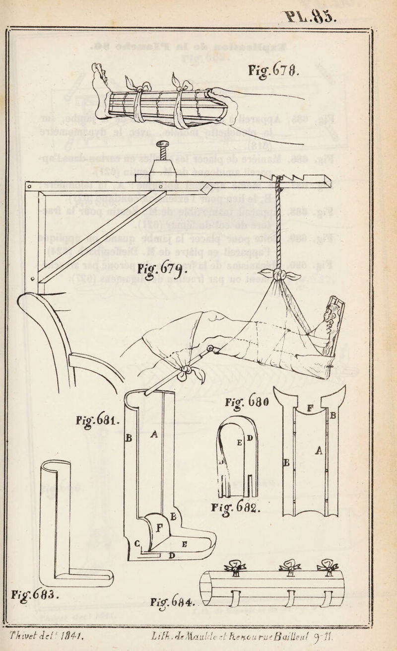 — 69 rons pas ; seulement je ferai remarquer que le lien n'est que la cravate tordue (pL 5, fig. 39), DES BANDAGES PAR RÉGION. 128. L’ordre topographique me paraît préférable à celui qui consiste à décrire successivement tous les bandages qui composent les différens groupes ou genres, comme les circu¬ laires, les obliques , les spiraux, les huits, etc., parce qu’il est difficile que l’esprit puisse se rappeler, dans tous ces ban¬ dages, ceux qui sont applicables à telle ou telle région. A part cela , cet ordre de description est très bon, en ce sens que l’application est à peu près la même pour tous ceux qui (ont partie du même groupe,- ce qui soulage considérable¬ ment la mémoire. J’ai remédié à cela en faisant précéder la description des bandages en particulier , de celle des diffé¬ rens genres ( 116 et suiv. ). De plus, dans l’ordre que j’ai suivi, j’ai pu donner des considérations générales sur les pré¬ cautions à prendre , et qui sont communes à tous les ban¬ dages de la même région. Nous décrirons successivement les bandages de la tête, du tronc, des membres supérieurs et des membres inférieurs. RÉGION DE LA TÊTE. 129. Considérations générales. Les bandes dont on se sert doivent être douces; elles auront deux bons travers de doigt de largeur ou cinq centimètres : plus larges elles ne s’appli¬ queraient pas dans toute l’étendue de leur plein , surtout si elles n’étaient pas très molles. Si la face est le siège du mal, il faut recouvrir la tête d’un bonnet ou d’un serre-tête pour empêcher le glissement des bandes ; si c’est le crâne, on n’applique ni serre-tête ni bon¬ net , mais seulement les premières pièces d’appareil néces¬ saires. La forme sphérique de la tête rend l’application des bandages très difficile ; de plus le mécanisme en est géné-