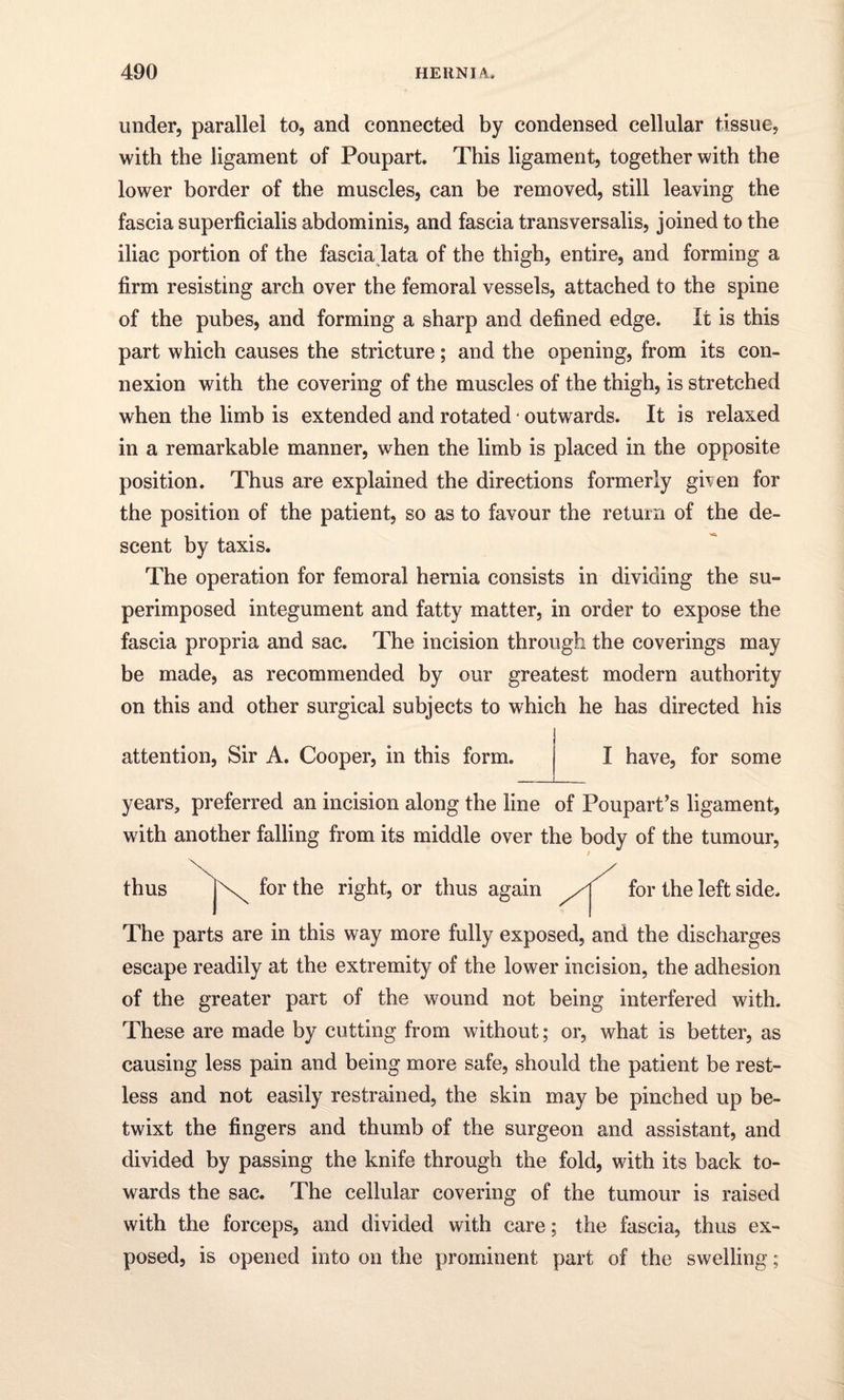 under, parallel to, and connected by condensed cellular tissue, with the ligament of Poupart. This ligament, together with the lower border of the muscles, can be removed, still leaving the fascia superficialis abdominis, and fascia transversalis, joined to the iliac portion of the fascia lata of the thigh, entire, and forming a firm resisting arch over the femoral vessels, attached to the spine of the pubes, and forming a sharp and defined edge. It is this part which causes the stricture; and the opening, from its con¬ nexion with the covering of the muscles of the thigh, is stretched when the limb is extended and rotated * outwards. It is relaxed in a remarkable manner, when the limb is placed in the opposite position. Thus are explained the directions formerly given for the position of the patient, so as to favour the return of the de¬ scent by taxis. The operation for femoral hernia consists in dividing the su¬ perimposed integument and fatty matter, in order to expose the fascia propria and sac. The incision through the coverings may be made, as recommended by our greatest modern authority on this and other surgical subjects to which he has directed his attention, Sir A. Cooper, in this form. _ I have, for some years, preferred an incision along the line of Poupart’s ligament, with another falling from its middle over the body of the tumour, thus Xj\ for the right, or thus again for the left side. The parts are in this way more fully exposed, and the discharges escape readily at the extremity of the lower incision, the adhesion of the greater part of the wound not being interfered with. These are made by cutting from without; or, what is better, as causing less pain and being more safe, should the patient be rest¬ less and not easily restrained, the skin may be pinched up be¬ twixt the fingers and thumb of the surgeon and assistant, and divided by passing the knife through the fold, with its back to¬ wards the sac. The cellular covering of the tumour is raised with the forceps, and divided with care; the fascia, thus ex¬ posed, is opened into on the prominent part of the swelling;