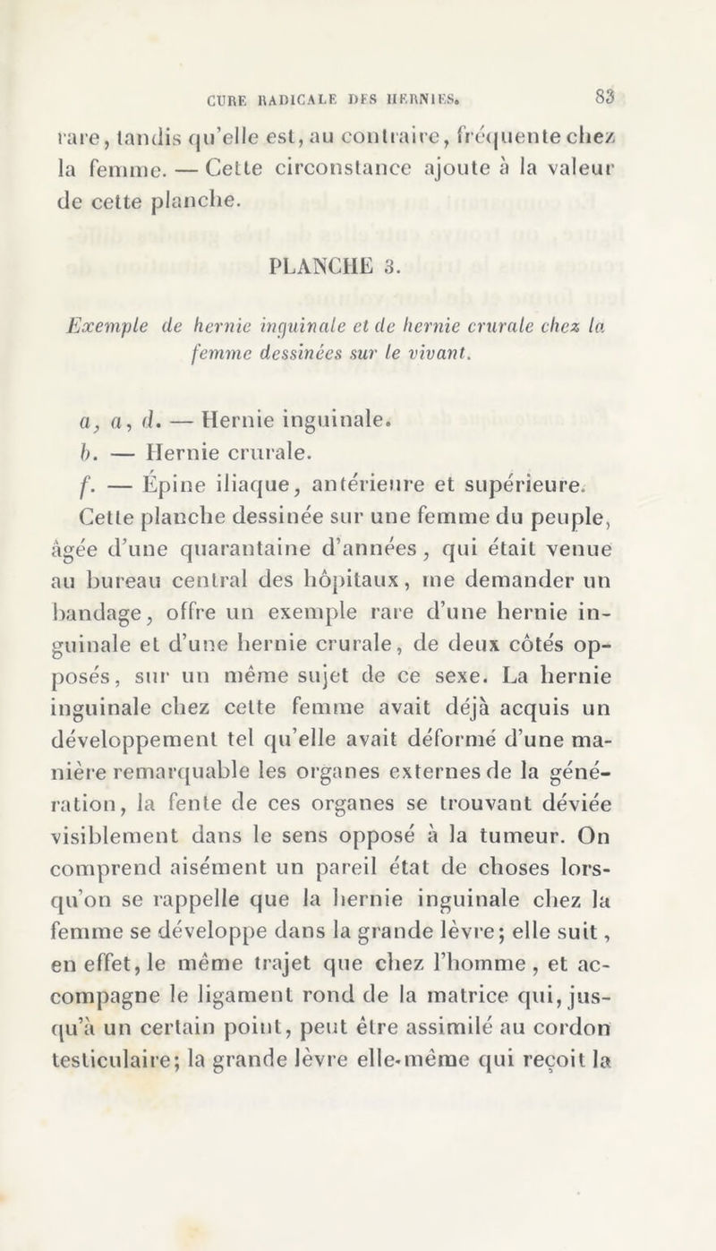 rare, tandis qu’elle est, au contraire, fréquente chez la femme. — Cette circonstance ajoute à la valeur de cette planche. PLANCHE 3. Exemple de hernie inguinale et de hernie crurale chez la femme dessinées sur le vivant. a, a, (L — Hernie inguinale. b. — Hernie crurale. f. — Épine iliaque, antérieure et supérieure. Cette planche dessinée sur une femme du peuple, âgée d’une quarantaine d’années, qui était venue au bureau central des hôpitaux, me demander un bandage, offre un exemple rare d’une hernie in- guinale et d’une hernie crurale, de deux côtés op- posés, sur un même sujet de ce sexe. La hernie inguinale chez celte femme avait déjà acquis un développement tel qu elle avait déformé d une ma- nière remarquable les organes externes de la géné- ration, la fente de ces organes se trouvant déviée visiblement dans le sens opposé à la tumeur. On comprend aisément un pareil état de choses lors- qu’on se rappelle que la hernie inguinale chez la femme se développe dans la grande lèvre; elle suit, en effet, le même trajet que chez l’homme, et ac- compagne le ligament rond de la matrice qui, jus- qu’à un certain point, peut être assimilé au cordon testiculaire; la grande lèvre elle*même qui reçoit la