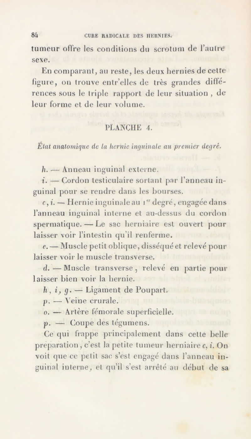 tumeur offre les conditions du scrotum de l'autre sexe. En comparant, au reste, les deux hernies de celte figure, on trouve entr’elles de très grandes diffé- rences sous le triple rapport de leur situation , de leur forme et de leur volume. PLANCHE 4. État anatomique de la hernie inguinale au premier degré. h. — Anneau inguinal externe. i. —Cordon testiculaire sortant par l’anneau in- guinal pour se rendre dans les bourses. e,i. —Hernie inguinale au ier degré, engagée dans l’anneau inguinal interne et au-dessus du cordon spermatique. — Le sac herniaire est ouvert pour laisser voir l’intestin qu’il renferme. e. — Muscle petit oblique, disséqué et relevé pour laisser voir le muscle transverse. d. — Muscle transverse , relevé en partie pour laisser bien voir la hernie. h, i, g. — Ligament de Poupart. p. — Veine crurale. o. — Artère fémorale superficielle. p. — Coupe des légume ns. Ce qui frappe principalement dans cette belle préparation , c’est la petite tumeur herniaire c, i. On voit que ce petit sac s’est engagé dans l’anneau in- guinal interne, et qu’il s’est arrêté au début de sa