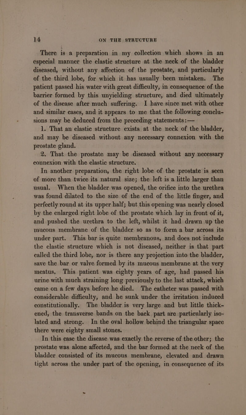 There is a preparation in my collection which shows in an especial manner the elastic structure at the neck of the bladder diseased, without any affection of the prostate, and particularly of the third lobe, for which it has usually been mistaken. The patient passed his water with great difficulty, m consequence of the barrier formed by this unyielding structure, and died ultimately of the disease after much suffering. I have since met with other and similar cases, and it appears to me that the following conclu- sions may be deduced from the preceding statements : — 1. That an elastic structure exists at the neck of the bladder, and may be diseased without any necessary connexion with the prostate gland. 2. That. the prostate may be diseased without any necessary connexion with the elastic structure. In another preparation, the right lobe of the prostate is seen of more than twice its natural size; the left is a little larger than usual. When the bladder was opened, the orifice into the urethra was found dilated to the size of the end of the little finger, and perfectly round at its upper half; but this opening was nearly closed by the enlarged right lobe of the prostate which lay in front of it, and pushed the urethra to the left, whilst it had drawn up the mucous membrane of the bladder so as to form a bar across its under part. This bar is quite membranous, and does not include the elastic structure which is not diseased, neither is that part called the third lobe, nor is there any projection into the bladder, save the bar or valve formed by its mucous membrane at the very meatus. This patient was eighty years of age, had passed his urine with much straining long previously to the last attack, which came on a few days before he died. The catheter was passed with considerable difficulty, and he sunk under the irritation induced constitutionally. The bladder is very large and but little thick- ened, the transverse bands on the back. part are particularly iso- lated and strong. In the oval hollow behind the triangular space there were eighty small stones. In this case the disease was exactly the reverse of the other; the prostate was alone affected, and the bar formed at the neck of the bladder consisted of its mucous membrane, elevated and drawn tight across the under part of the opening, in consequence of its