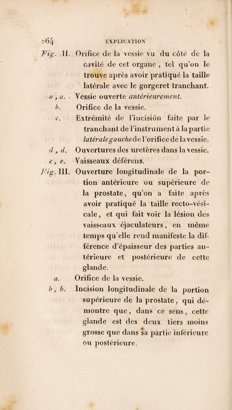 / ?6/{ EXPLICATION Fig. 11. Orifice de la vessie vu du côté de la cavité de cet organe , tel qu’on le trouve après avoir pratiqué la taille latérale avec le gorgeret tranchant. a y a. Vessie ouverte antérieurement. b. Orifice de la vessie. c. Extrémité de l’incision faite par le tranchant de l’instrument à la partie latérale gauche de l’orifice de la vessie. d d. Ouvertures des uretères dans la vessie. e j, e. Vaisseaux déférens. Fig. III. Ouverture longitudinale de la por¬ tion antérieure ou supérieure de la prostate, qu’on a faite apres avoir pratiqué la taille recto-vési¬ cale , et qui fait voir la lésion des vaisseaux éjaculateurs, en même temps qu’elle rend manifeste la dif¬ férence d’épaisseur des parties an¬ térieure et postérieure de cette glande. a. Orifice de la vessie. b, h. Incision longitudinale de la portion supérieure de la prostate, qui dé¬ montre que, dans ce sens, cette glande est des deux tiers moins grosse que dans sa partie inférieure ou postérieure.