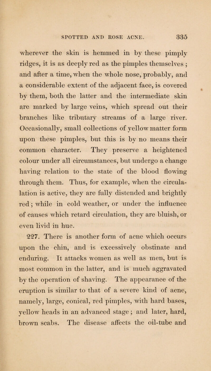 wherever the skin is hemmed in by these pimply ridges, it is as deeply red as the pimples themselves ; and after a time, when the whole nose, probably, and a considerable extent of the adjacent face, is covered by them, both the latter and the intermediate skin are marked by large veins, which spread out their branches like tributary streams of a large river. Occasionally, small collections of yellow matter form upon these pimples, but this is by no means their common character. They preserve a heightened colour under all circumstances, but undergo a change having relation to the state of the blood flowing through them. Thus, for example, when the circula- lation is active, they are fully distended and brightly red; while in cold weather, or under the influence of causes which retard circulation, they are bluish, or even livid in hue. 227. There is another form of acne which occurs upon the chin, and is excessively obstinate and enduring. It attacks women as well as men, but is most common in the latter, and is much aggravated by the operation of shaving. The appearance of the eruption is similar to that of a severe kind of acne, namely, large, conical, red pimples, with hard bases, yellow heads in an advanced stage; and later, hard, brown scabs. The disease affects the oil-tube and