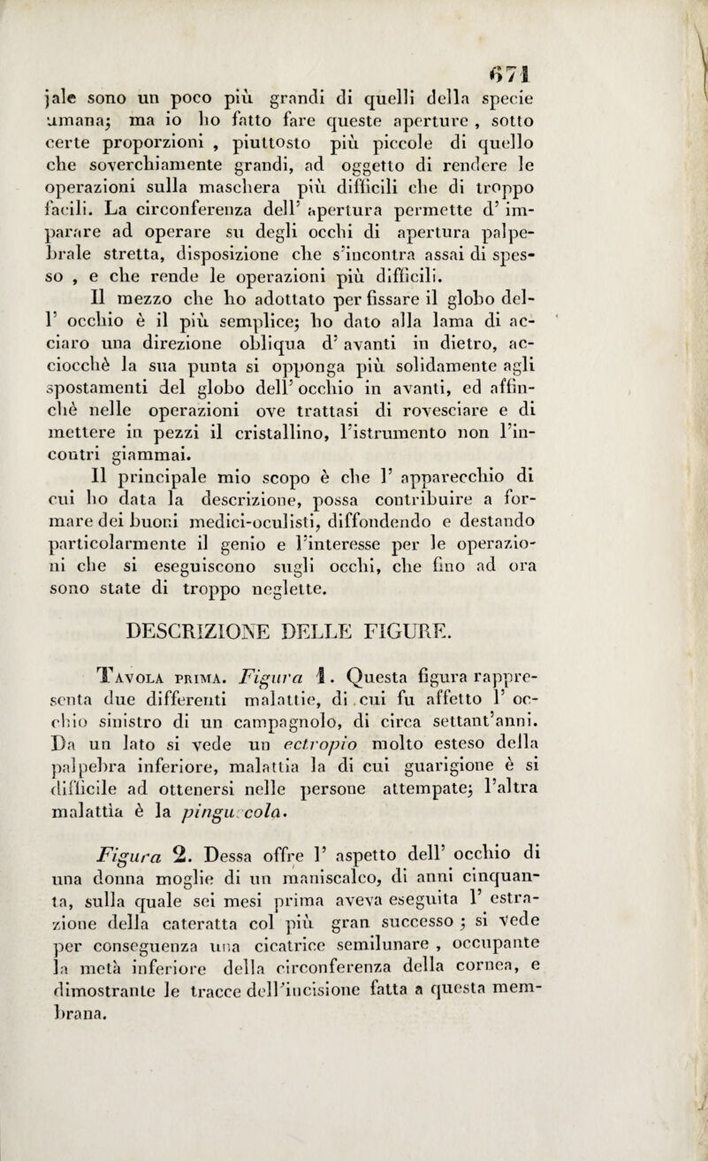 jale sono un poco più grandi di quelli della specie umana; ma io ho fatto fare queste aperture , sotto certe proporzioni , piuttosto più piccole di quello che soverchiamente grandi, ad oggetto di rendere le operazioni sulla maschera più difficili che di troppo facili. La circonferenza delh apertura permette d’ im¬ parare ad operare su degli occhi di apertura palpe¬ brale stretta, disposizione die s'incontra assai di spes¬ so , e che rende le operazioni più difficili. Il mezzo che ho adottato per fissare il globo del- 1 occhio è il più semplice; ho dato alla lama di ac¬ ciaro una direzione obliqua d’ avanti in dietro, ac¬ ciocché la sua punta si opponga più solidamente agli spostamenti del globo dell5 occhio in avanti, ed affin¬ chè nelle operazioni ove trattasi di rovesciare e di mettere in pezzi il cristallino, ristrumento non rin¬ contri giammai. Il principale mio scopo è che l5 apparecchio di cui ho data la descrizione, possa contribuire a for¬ mare dei buoni medici-oculisti, diffondendo e destando particolarmente il genio e l5interesse per le operazio¬ ni che si eseguiscono sugli occhi, che fino ad ora sono state di troppo neglette. DESCRIZIONE DELLE FIGURE. Tavola prima. Figura i. Questa figura rappre¬ senta due differenti malattie, di .cui fu affetto l5 oc¬ chio sinistro di un campagnolo, di circa settant anni. Da un lato si vede un ectropio molto esteso della palpebra inferiore, malattia la di cui guarigione è si difficile ad ottenersi nelle persone attempate; l’altra malattìa è la pingue colei* Figura 2. Dessa offre 1’ aspetto dell’ occhio di una donna moglie di un maniscalco, di anni cinquan¬ ta, sulla quale sei mesi prima aveva eseguita 1’ estra¬ zione della cateratta col più gran successo ; si vede per conseguenza una cicatrice semilunare , occupante la metà inferiore della circonferenza della cornea, e dimostrante le tracce dell incisione fatta a questa mem¬ brana.