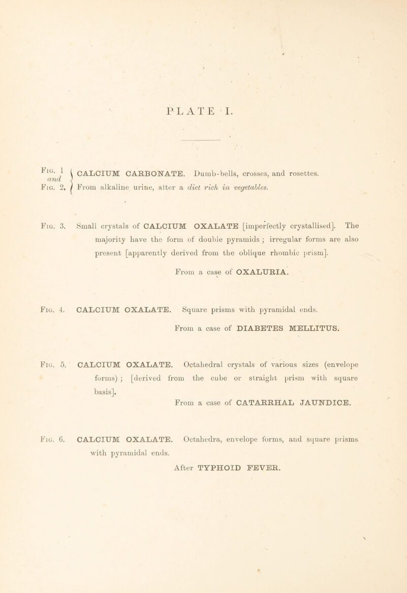 PLATE I. i ig. 1 ( CALCIUM CARBONATE. Dumb-bells, crosses, and rosettes. and ; Fig. 2, / From alkaline urine, alter a diet rich in vegetables. Fig. 3. Small crystals of CALCIUM OXALATE [imperfectly crystallised]. The majority have the form of double pyramids ; irregular forms are also present [apparently derived from the oblique rhombic prism]. From a case of OXALURIA. v. Fig. 4. CALCIUM OXALATE. Square prisms with pyramidal ends. From a case of DIABETES MELLITUS. Fig. 5. CALCIUM OXALATE. Octahedral crystals of various sizes (envelope forms) ; [derived from the cube or straight prism with square basis]. From a case of CATARRHAL JAUNDICE. Fig. 6. CALCIUM OXALATE. Octahedra, envelope forms, and square prisms with pyramidal ends. N After TYPHOID FEVER.