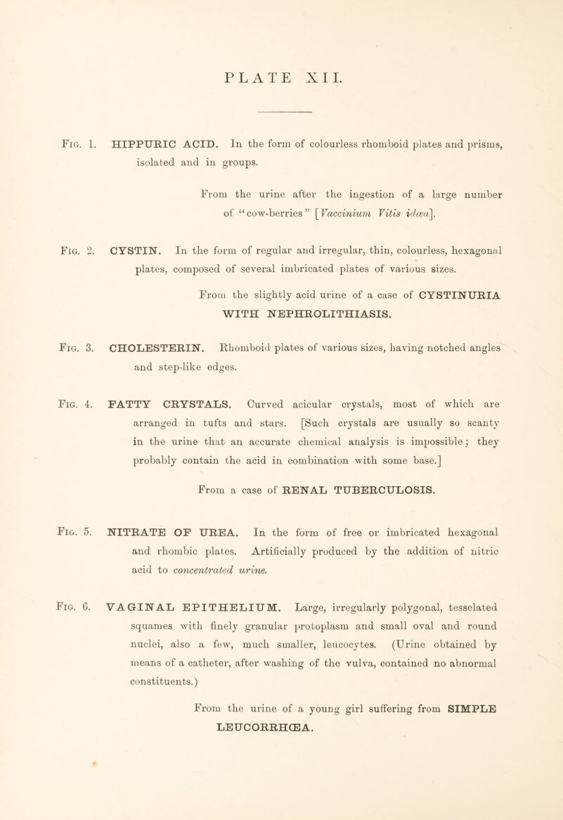 Fig. 1 Fig. 2 Fig. 3. Fig. 4. Fig. 5. Fig. 6. HIPPURIC ACID. In the form of colourless rhomboid plates and prisms, isolated and in groups. From the urine after the ingestion of a large number of “cow-berries” [Vaccinium Vitis idcea\. CYSTIN. In the form of regular and irregular, thin, colourless, hexagonal plates, composed of several imbricated plates of various sizes. From the slightly acid urine of a case of CYSTINURIA WITH NEPHROLITHIASIS. CHOLESTERIN. Rhomboid plates of various sizes, having notched angles and step-like edges. FATTY CRYSTALS. Curved acicular crystals, most of which are arranged in tufts and stars. [Such crystals are usually so scanty in the urine that an accurate chemical analysis is impossible; they probably contain the acid in combination with some base.] From a case of RENAL TUBERCULOSIS. NITRATE OF UREA. In the form of free or imbricated hexagonal and rhombic plates. Artificially produced by the addition of nitric acid to concentrated urine. VAGINAL EPITHELIUM. Large, irregularly polygonal, tesselated squames with finely granular protoplasm and small oval and round nuclei, also a few, much smaller, leucocytes. (Urine obtained by means of a catheter, after washing of the vulva, contained no abnormal constituents.) From the urine of a young girl suffering from SIMPLE LEUCORRHCEA.