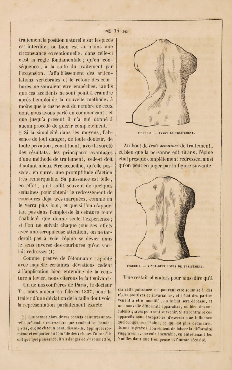 traitement la position naturelle sur les pieds est interdite, ou bien est au moins une circonstance exceptionnelle, dans celle-ci c’est la règle fondamentale; qu’en con¬ séquence , à la suite du traitement par l’extension, l’affaiblissement des articu¬ lations vertébrales et le retour des cour¬ bures ne sauraient être empêchés, tandis que ces accidents ne sont point à craindre après l’emploi de la nouvelle méthode, à moins que le cas ne soit du nombre de ceux dont nous avons parié en commençant, et que jusqu’à présent il n’a été donné à aucun procédé de guérir complètement. Si la simplicité dans les moyens, l’ab- sence de tout danger, de toute douleur, de toute privation, constituent, avec la sûreté des résultats, les principaux avantages d’une méthode de traitement, celle-ci doit d’autant mieux être accueillie, qu’elle pos¬ sède, en outre, une promptitude d’action très remarquable. Sa puissance est telle, en effet, qu’il suffit souvent de quelques semaines pour obtenir le redressement de courbures déjà très marquées, comme on le verra plus loin, et que si l’on n’appor- lait pas dans l’emploi de la ceinture toute l’habileté que donne seule l’expérience ; si l’on ne suivait chaque jour ses effets avec une scrupuleuse attention, on ne tar¬ derait pas à voir l’épine se dévier dans le sens inverse des courbures qu’on vou¬ lait redresser (1). Comme preuve de l’étonnante rapidité avec laquelle certaines déviations cèdent à l’application bien entendue de la cein¬ ture à levier, nous citerons le fait suivant : Un de nos confrères de Paris, le docteur T., nous amena sa fille en 1837, pour la traiter d’une déviation de la taille dont voici la représentation parfaitement exacte. (1) Que penser alors de ces corsets et autres appa¬ reils prétendus redresseurs que vendent les banda- gistes, etque chacun peut, disent-ils, appliquer soi- même et emporter au loin ? de deux choses l’une : s’ils ont quelque puissance, il y a danger de s’v soumettre, FIGUIIE 3. — AVANT LE TBAlTEMENT, Au bout de trois semaines de traitement, et bien que la personne eût 19 ans, l’épine était presque complètement, redressée, ainsi qu’on peut en juger par la figure suivante. Il ne restait plus alors pour ainsi dire qu’à car cette puissance ne pouvant être soumise à des règles positives et invariables, et l’état des parties venant à être modifié , ou le but sera dépassé, et une nouvelle difformité apparaîtra, ou bien des ac¬ cidents graves pourront survenir. Si ail contraire ces appareils sont incapables d’exercer une influence quelconque sur l’épine, ce qui est plus ordinaire, ils ont le grave inconvénient de laisser la difformité s’aggraver et devenir incurable, en entretenant les familles dans une trompeuse et funeste sécurité.