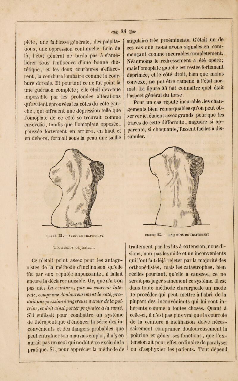 plète, une faiblesse générale, des palpita¬ tions, une oppression continuelle. Loin de là, l’état général ne tarda pas à s’amé¬ liorer sous l’influence d’une bonne dié¬ tétique , et les deux courbures s’effacè¬ rent, la courbure lombaire comme la cour¬ bure dorsale. Et pourtant ce ne fut point là une guérison complète; elle était devenue impossible par les profondes altérations qu’avaient éprouvées les côtes du côté gau¬ che , qui offraient une dépression telle que l’omoplate de ce côté se trouvait comme ensevelie, tandis que l’omoplate opposée, poussée fortement en arrière, en haut et en dehors, formait sous la peau une saillie angulaire très proéminente. C’était un de ces cas que nous avons signalés en com¬ mençant comme incurables complètement. Néanmoins le redressement a été opéré; mais l’omoplate gauche est restée fortement déprimée, et le côté droit, bien que moins convexe, ne put être ramené à l’état nor¬ mal. La figure 23 fait connaître quel était l’aspect général du torse. Pour un cas réputé incurable ,les chan¬ gements bien remarquables qu’on peut ob¬ server ici étaient assez grands pour que les traces de cette difformité, naguère si ap¬ parente, si choquante, fussent faciles à dis¬ simuler. ' Troisième objection. Ce n’était point assez pour les antago¬ nistes de la méthode d’inclinaison qu’elle fût par eux réputée impuissante, il fallait encore la déclarer nuisible. Or, que n’a-t-on pas dit? La ceinture, par sa courroie laté¬ rale, comprime douloureusement le côté,pro¬ duit une pression dangereuse autour de la poi¬ trine, et doit ainsi porter préjudice à la santé. S’il suffisait pour combattre un système de thérapeutique d’énoncer la série des in¬ convénients et des dangers probables que peut entraîner son mauvais emploi, il n’y en aurait pas un seul qui ne dût être exclu de la pratique. Si, pour apprécier la méthode de traitement par les lits à extension, nous di¬ sions, non pas les mille et un inconvénients qui l’ont fait déjà rejeter par la majorité des orthopédistes, mais les catastrophes, bien réelles pourtant, qu’elle a causées, ce ne serait pas juger sainement ce système. Il est dans toute méthode chirurgicale un mode de procéder qui peut mettre à l’abri de la plupart des inconvénients qui lui sont in¬ hérents comme à toutes choses. Quant à celle-ci, il rfest pas plus vrai que la courroie de la ceinture à inclinaison doive néces¬ sairement comprimer douloureusement la poitrine et gêner ses fonctions, que l’ex¬ tension ait pour effet ordinaire de paralyser ou d’asphyxier les patients. Tout dépend