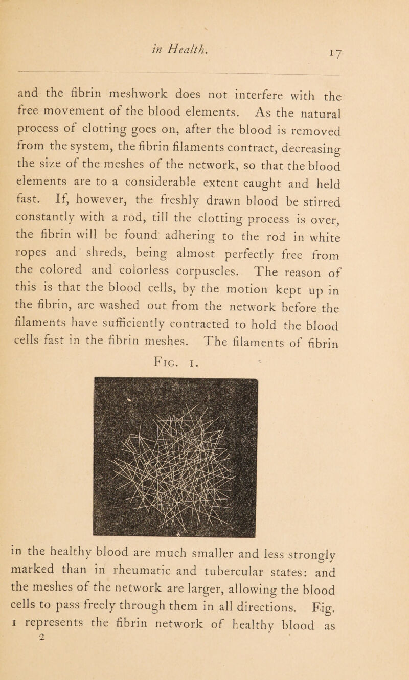 in Health. 17 and the fibrin meshwork does not interfere with the free movement of the blood elements. As the natural process of clotting goes on, after the blood is removed from the system, the fibrin filaments contract, decreasing the size of the meshes of the network, so that the blood elements are to a considerable extent caught and held fast. If, however, the freshly drawn blood be stirred constantly with a rod, till the clotting process is over, the fibrin will be found adhering to the rod in white ropes and shreds, being almost perfectly free from the colored and colorless corpuscles. The reason of this is that the blood cells, by the motion kept up in the fibrin, are washed out from the network before the filaments have sufficiently contracted to hold the blood cells fast in the fibrin meshes. The filaments of fibrin Fig. I. in the healthy blood are much smaller and less strongly marked than in rheumatic and tubercular states; and the meshes of the network are larger, allowing the blood cells to pass freely through them in all directions. Fig. I represents the fibrin network of healthy blood as 2